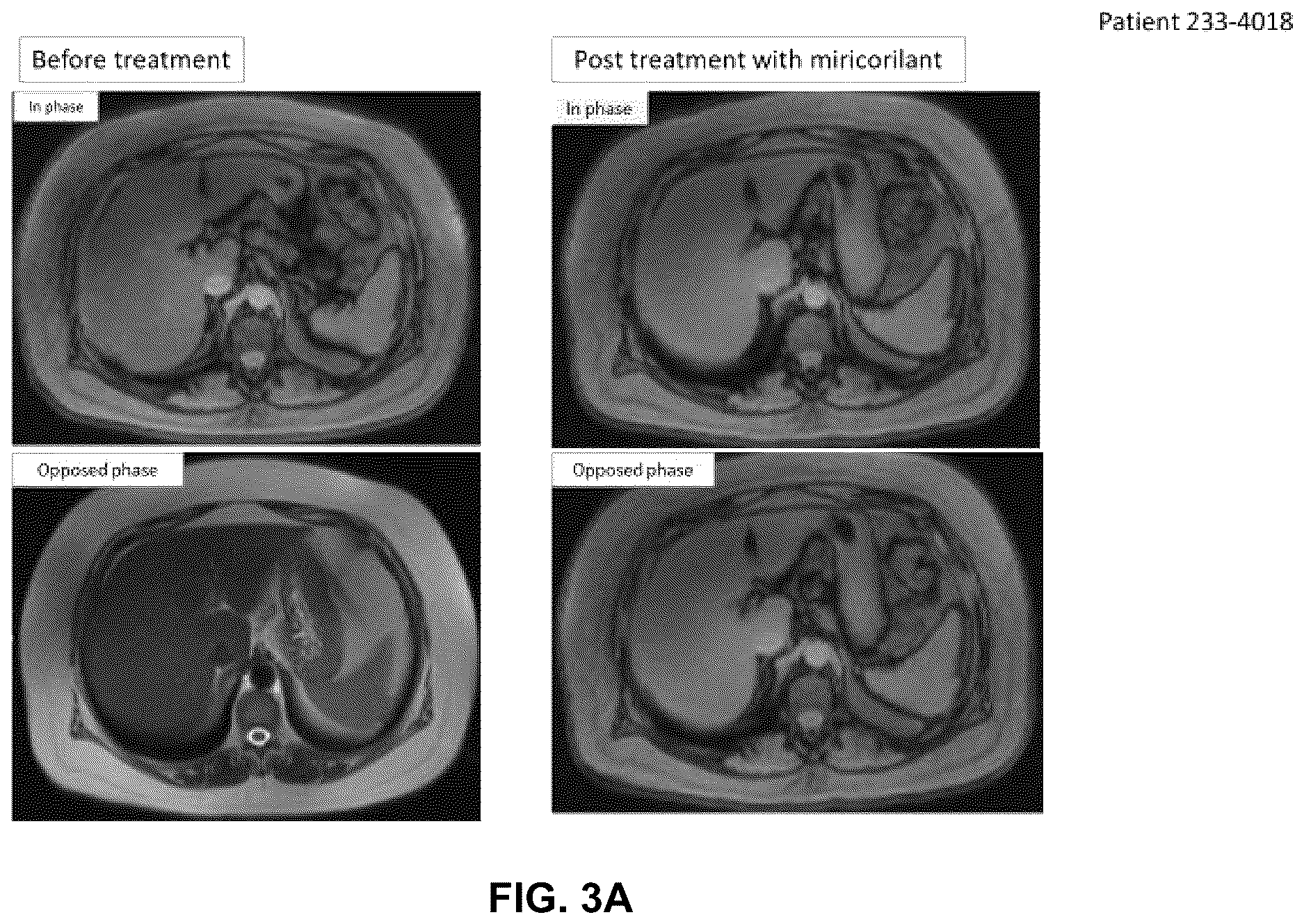 Patent US12616698 Figure 4 – Methods for reducing liver fat and for treating fatty liver disorders