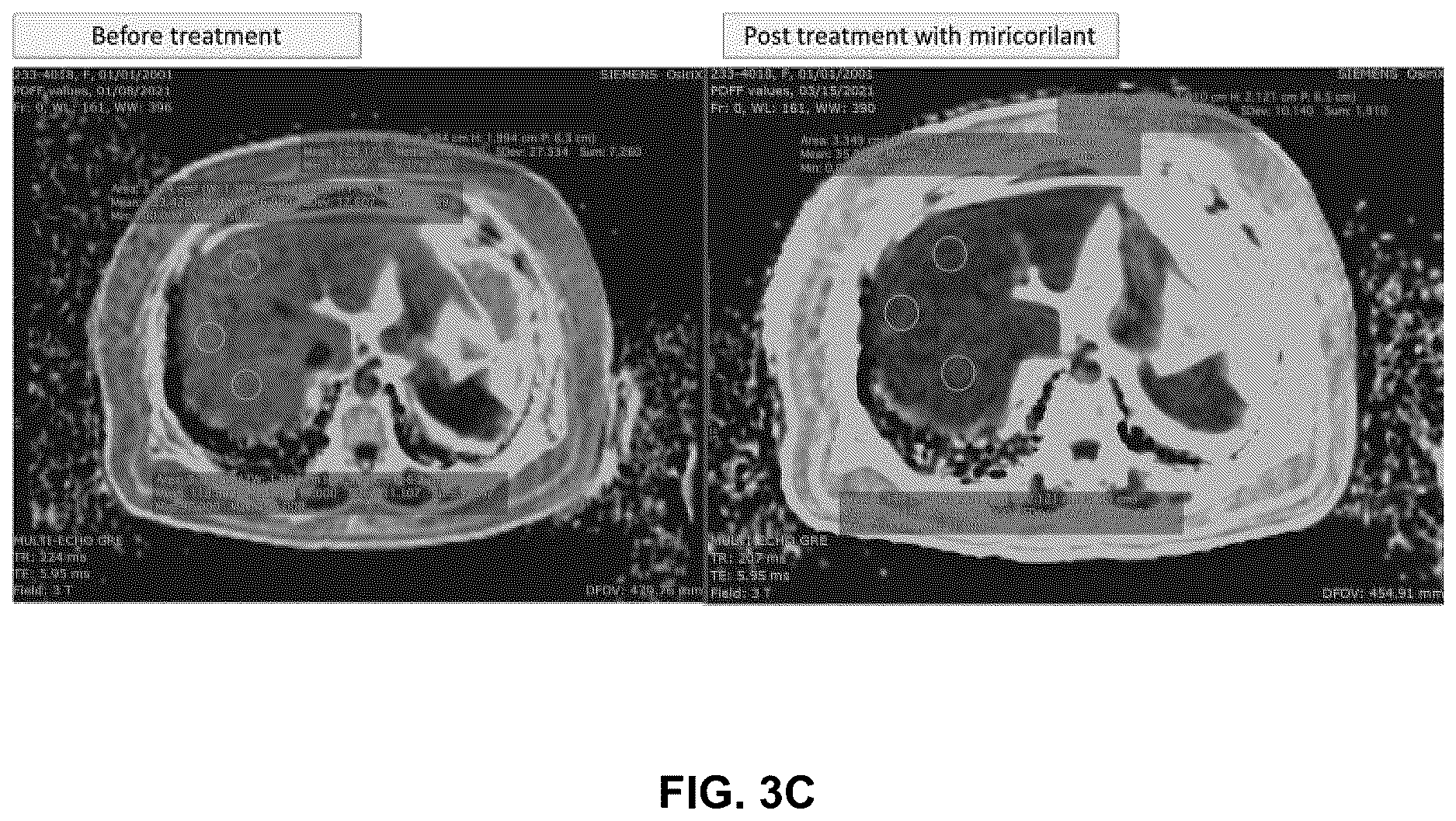 Patent US12616698 Figure 6 – Methods for reducing liver fat and for treating fatty liver disorders