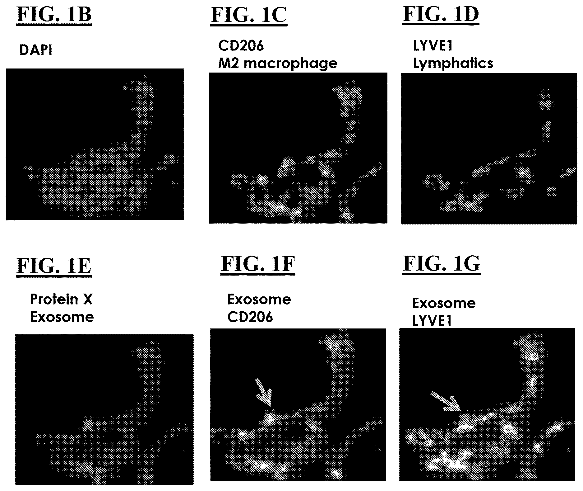Patent US12616712 Figure 2 – Sting agonist comprising exosomes for treating neuroimmunological disorders