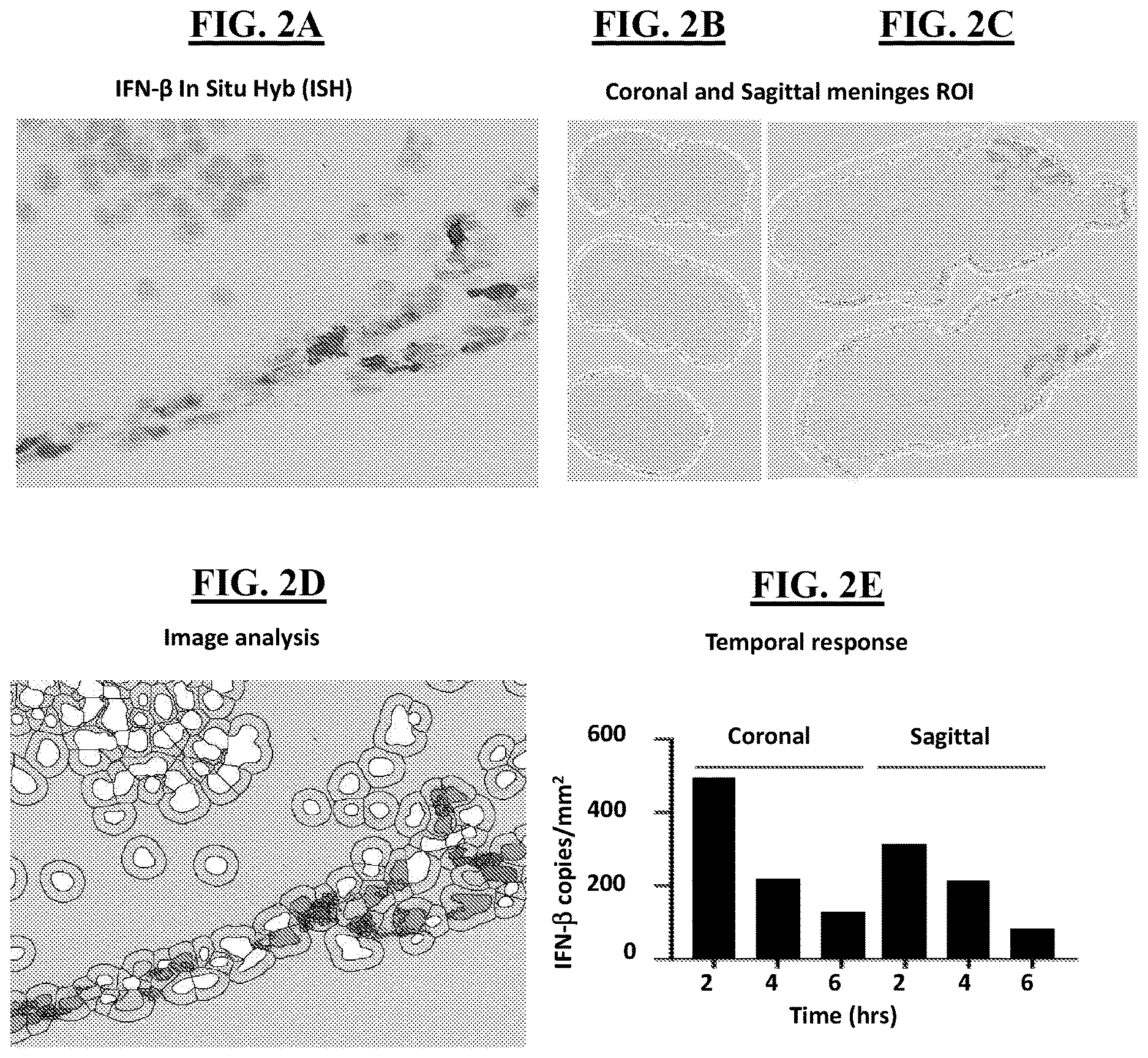 Patent US12616712 Figure 3 – Sting agonist comprising exosomes for treating neuroimmunological disorders