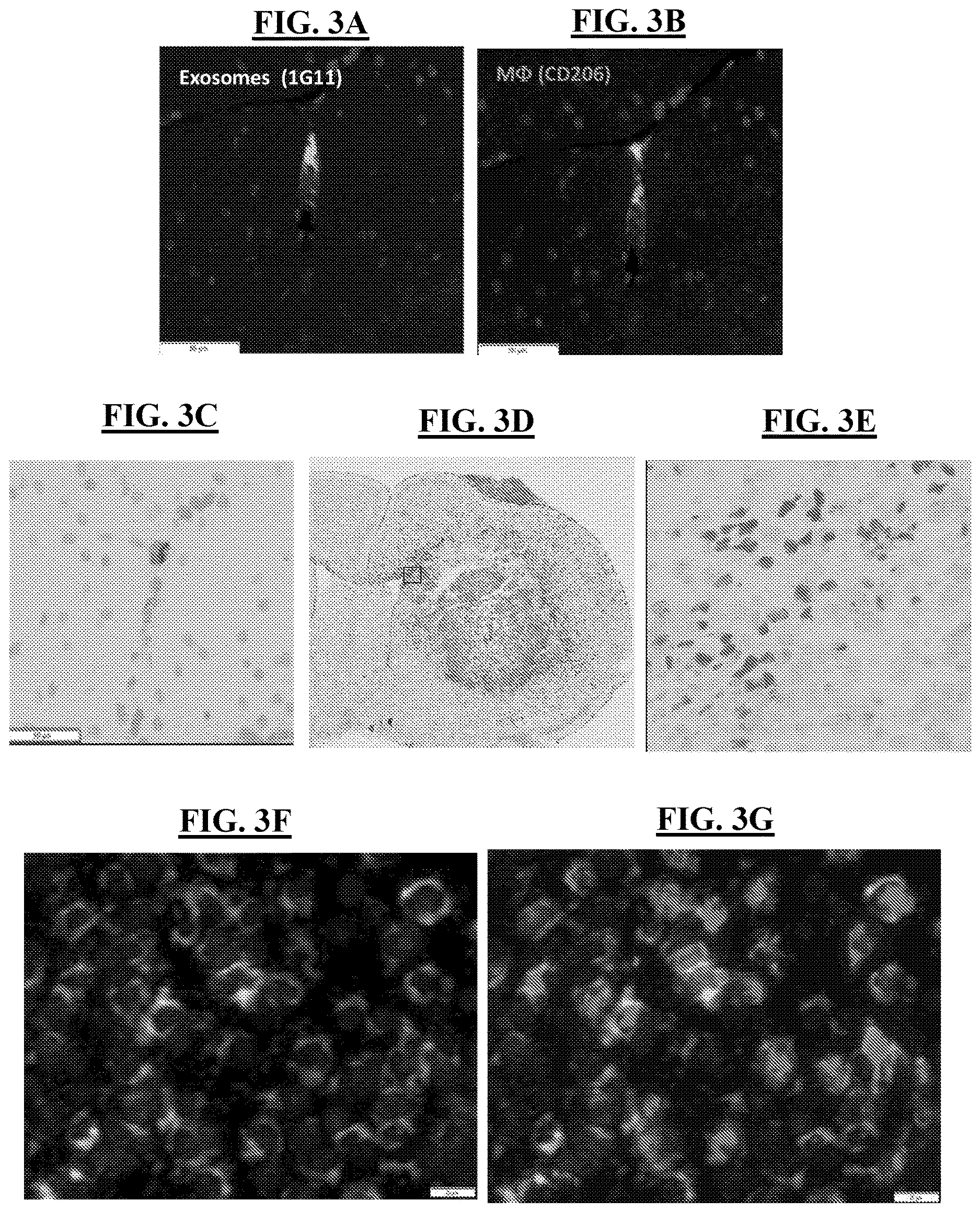 Patent US12616712 Figure 4 – Sting agonist comprising exosomes for treating neuroimmunological disorders