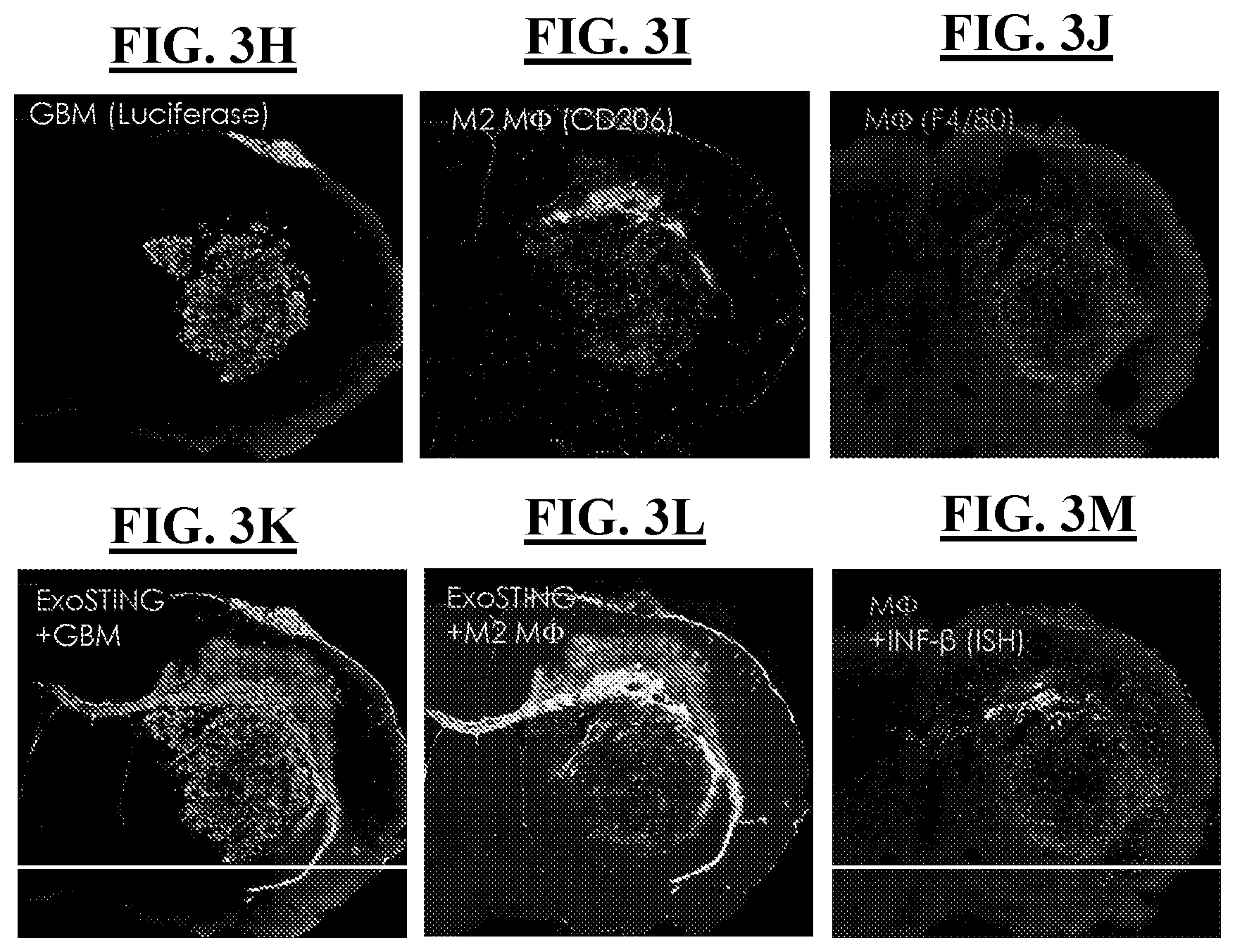 Patent US12616712 Figure 5 – Sting agonist comprising exosomes for treating neuroimmunological disorders