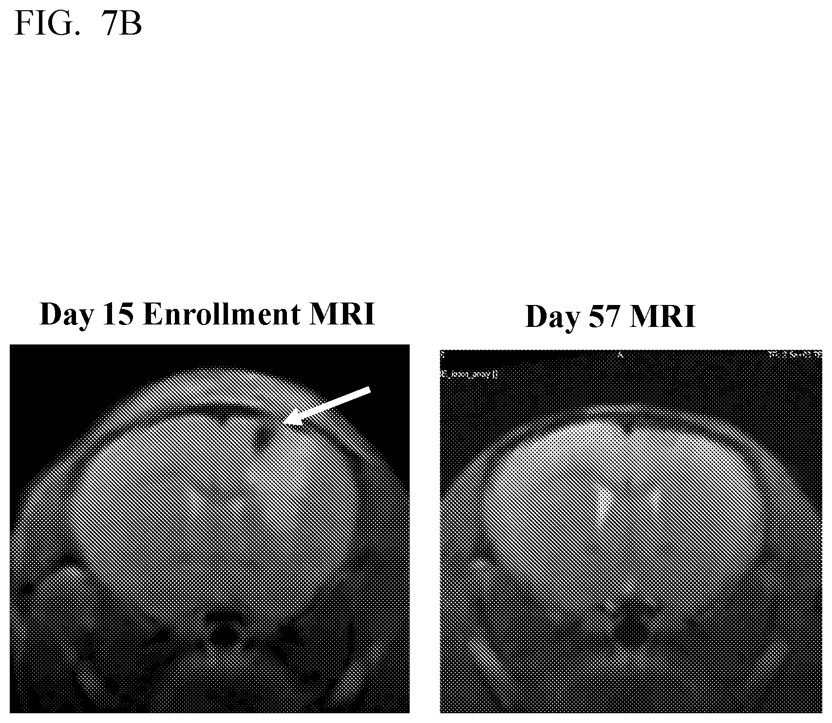 Patent US12616712 Figure 12 – Sting agonist comprising exosomes for treating neuroimmunological disorders