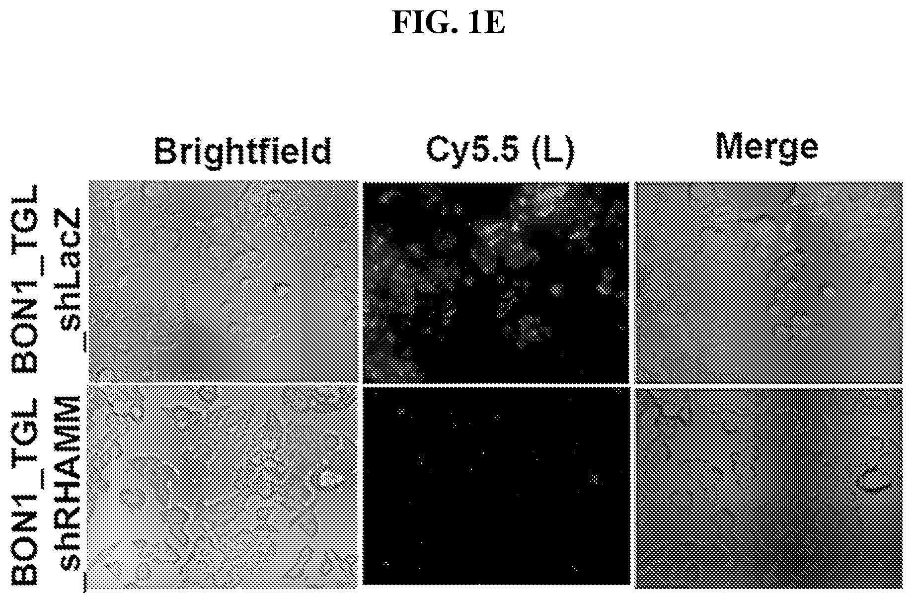 Patent US12616715 Figure 3 – Nanotherapy targeting RHAMM-positive tumors