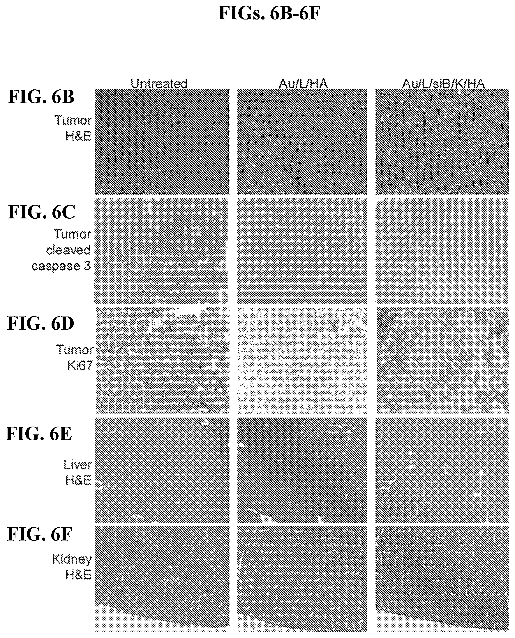 Patent US12616715 Figure 15 – Nanotherapy targeting RHAMM-positive tumors