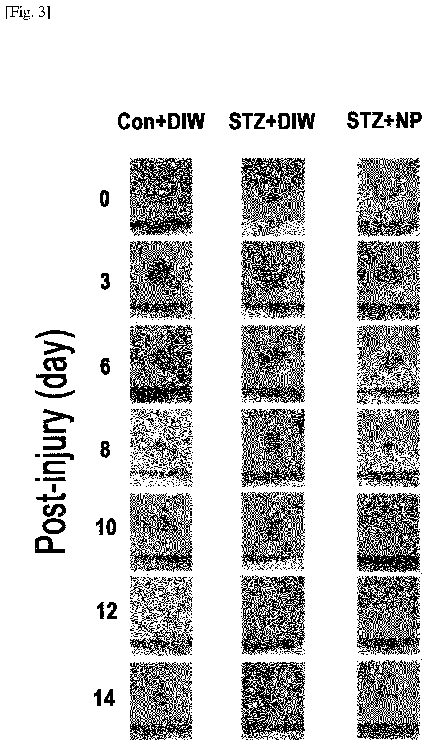 Patent US12616730 Figure 3 – Topical composition comprising an extract of combined herbs comprising longanae arillus for the treatment or alleviation of skin ulcer and the use thereof