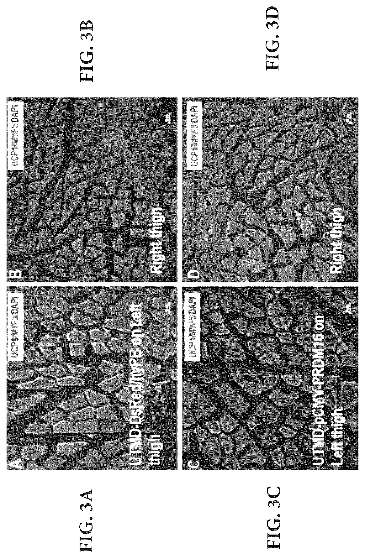Patent US12616735 Figure 10 – Compositions and methods of controlling expression of thermogenin (UCP-1) in skeletal muscles