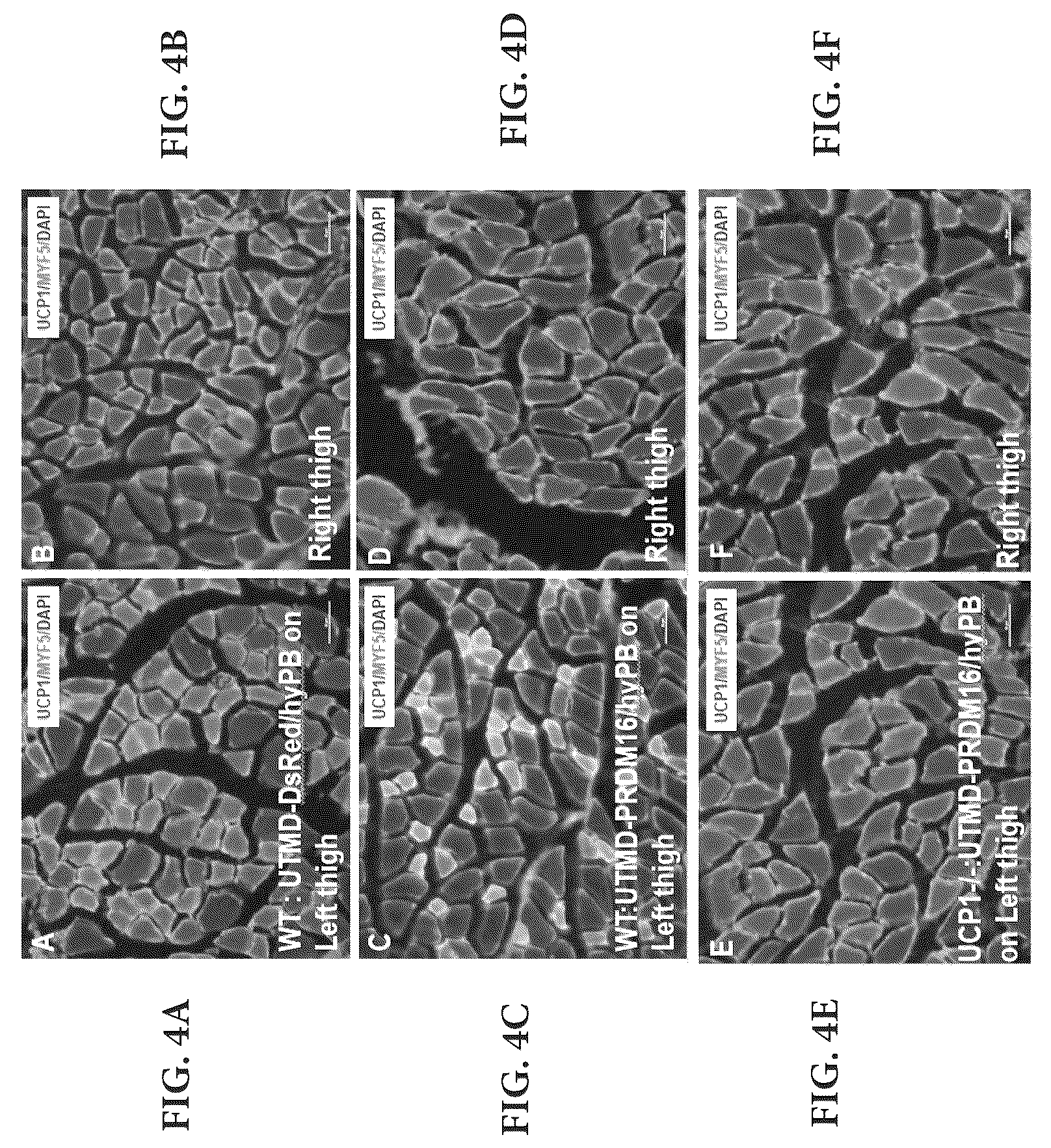 Patent US12616735 Figure 16 – Compositions and methods of controlling expression of thermogenin (UCP-1) in skeletal muscles
