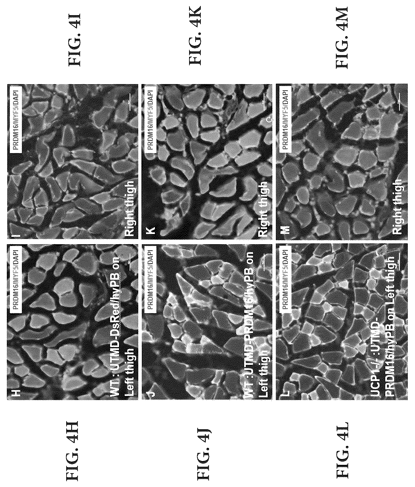 Patent US12616735 Figure 18 – Compositions and methods of controlling expression of thermogenin (UCP-1) in skeletal muscles