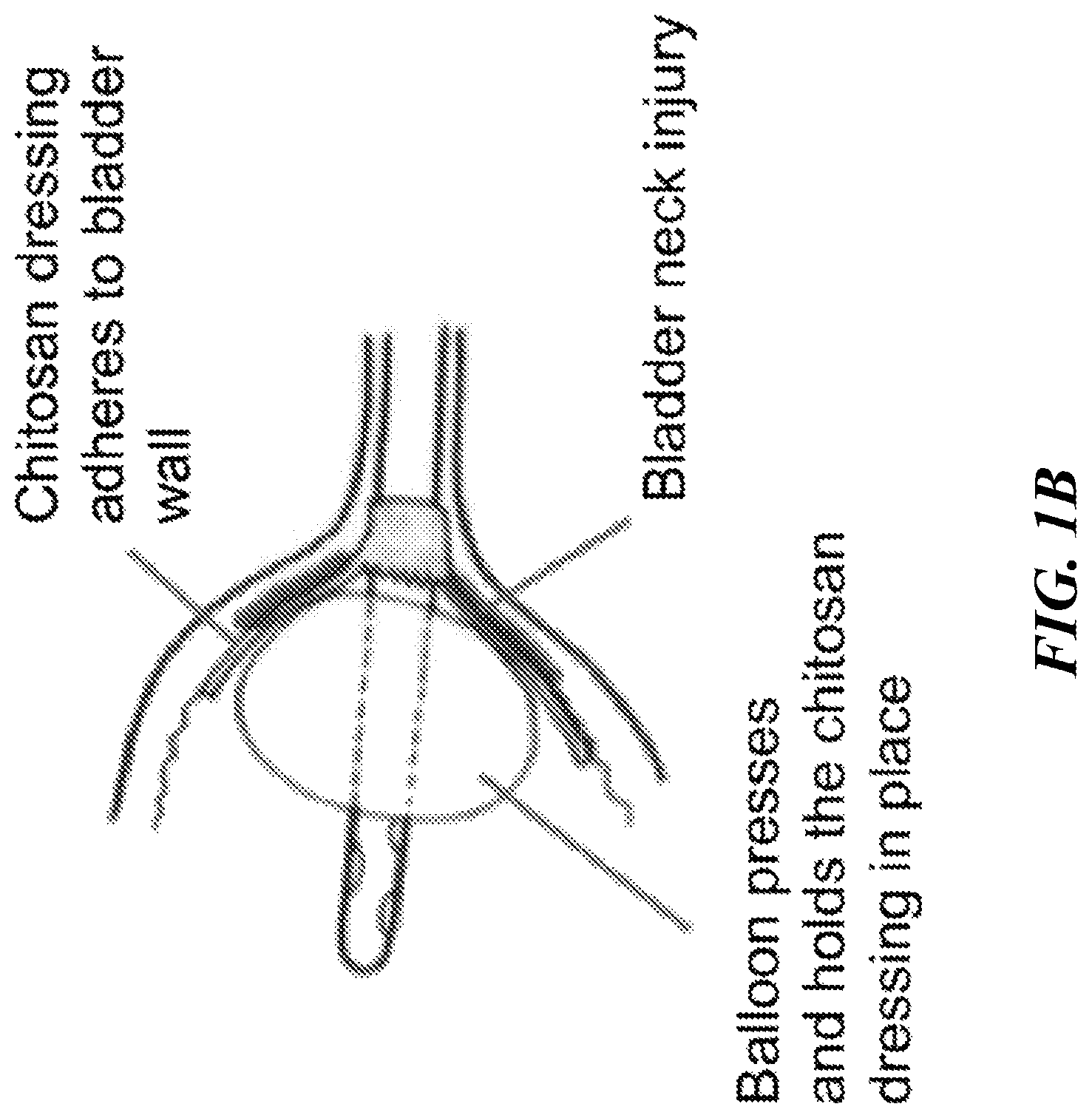 Patent US12616771 Figure 2 – Tissue adherent chitosan material that resists dissolution