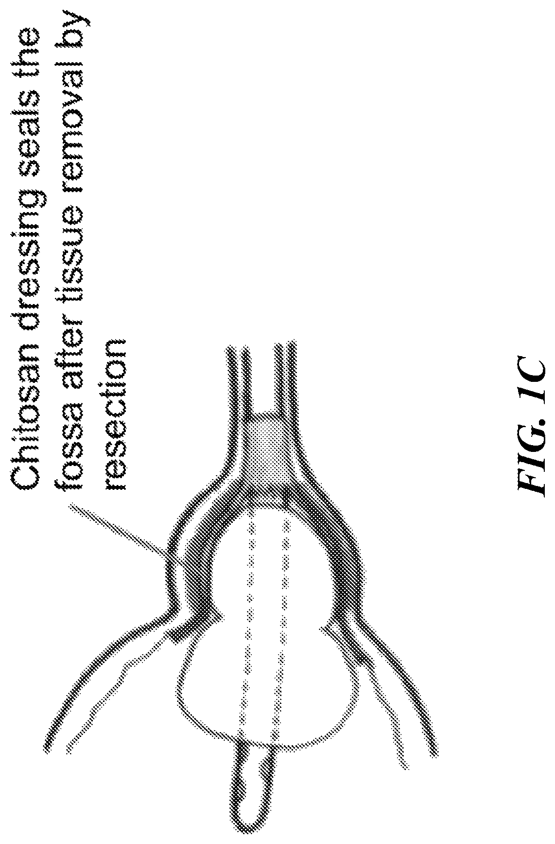 Patent US12616771 Figure 3 – Tissue adherent chitosan material that resists dissolution