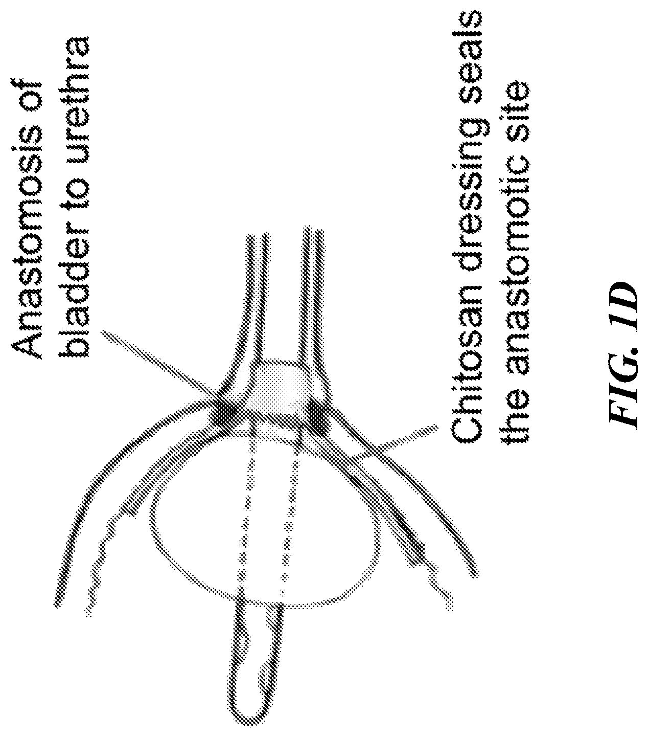 Patent US12616771 Figure 4 – Tissue adherent chitosan material that resists dissolution