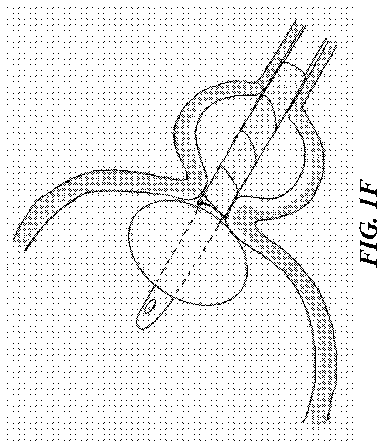 Patent US12616771 Figure 6 – Tissue adherent chitosan material that resists dissolution