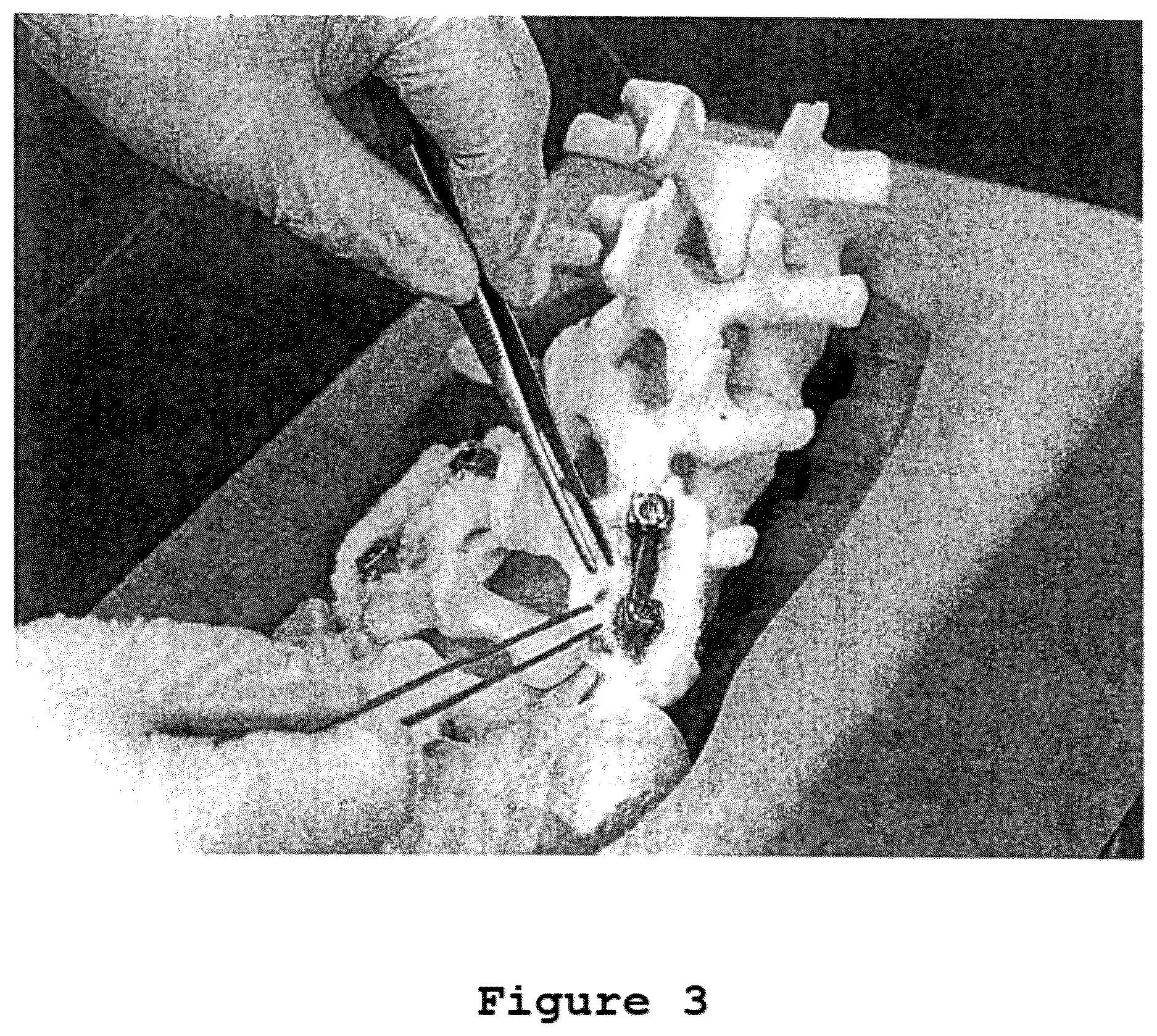 Patent US12616775 Figure 2 – Method for manufacturing bone-regeneration material comprising biodegradable fibers by using electrospinning method