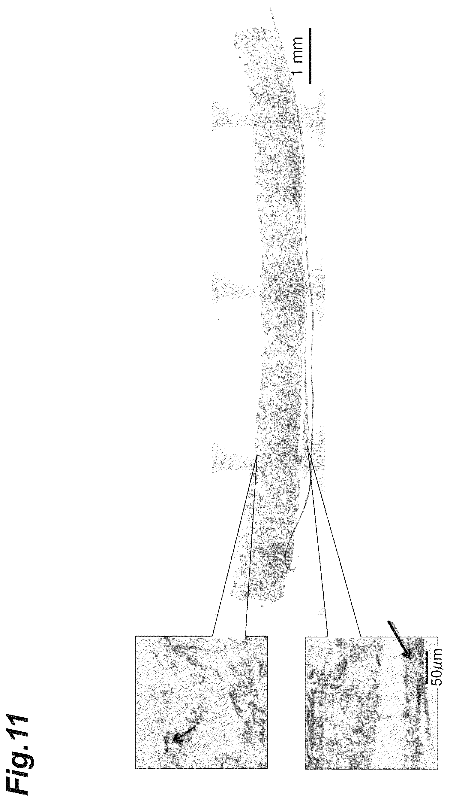 Patent US12616776 Figure 11 – Three-dimensional tissue body, method for producing same, and formation agent for three-dimensional tissue body