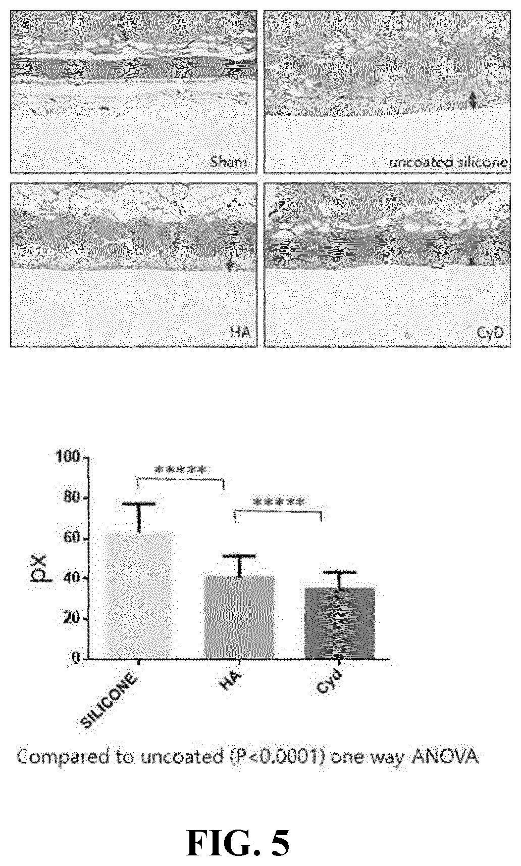 Patent US12616778 Figure 4 – Composite ultrathin coating film with inhibitory activity against hyperinflammatory response and bacteria, implant including same, and preparation method therefor
