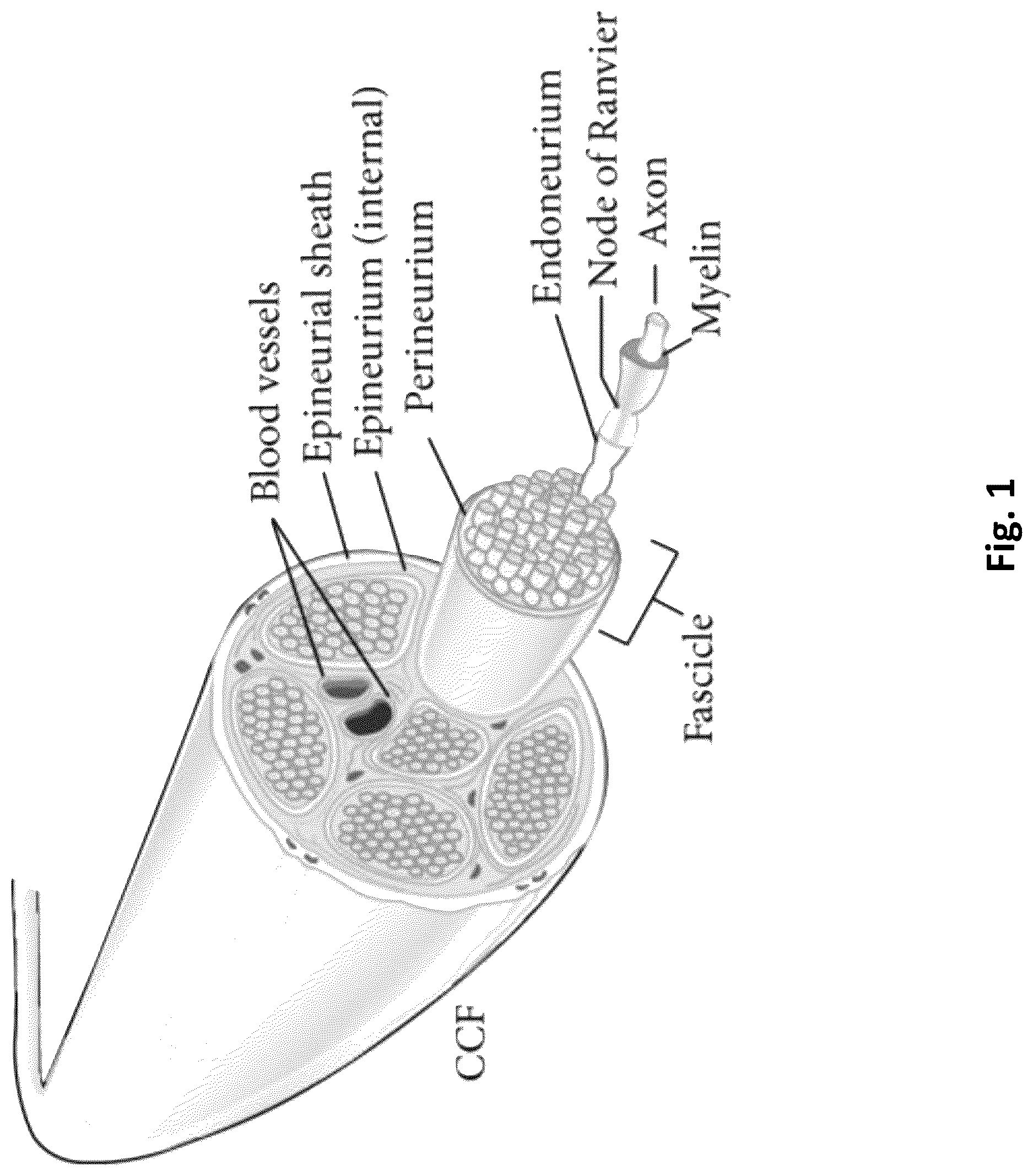 Patent US12616779 Figure 1 – Piezoelectric nerve guidance and regeneration