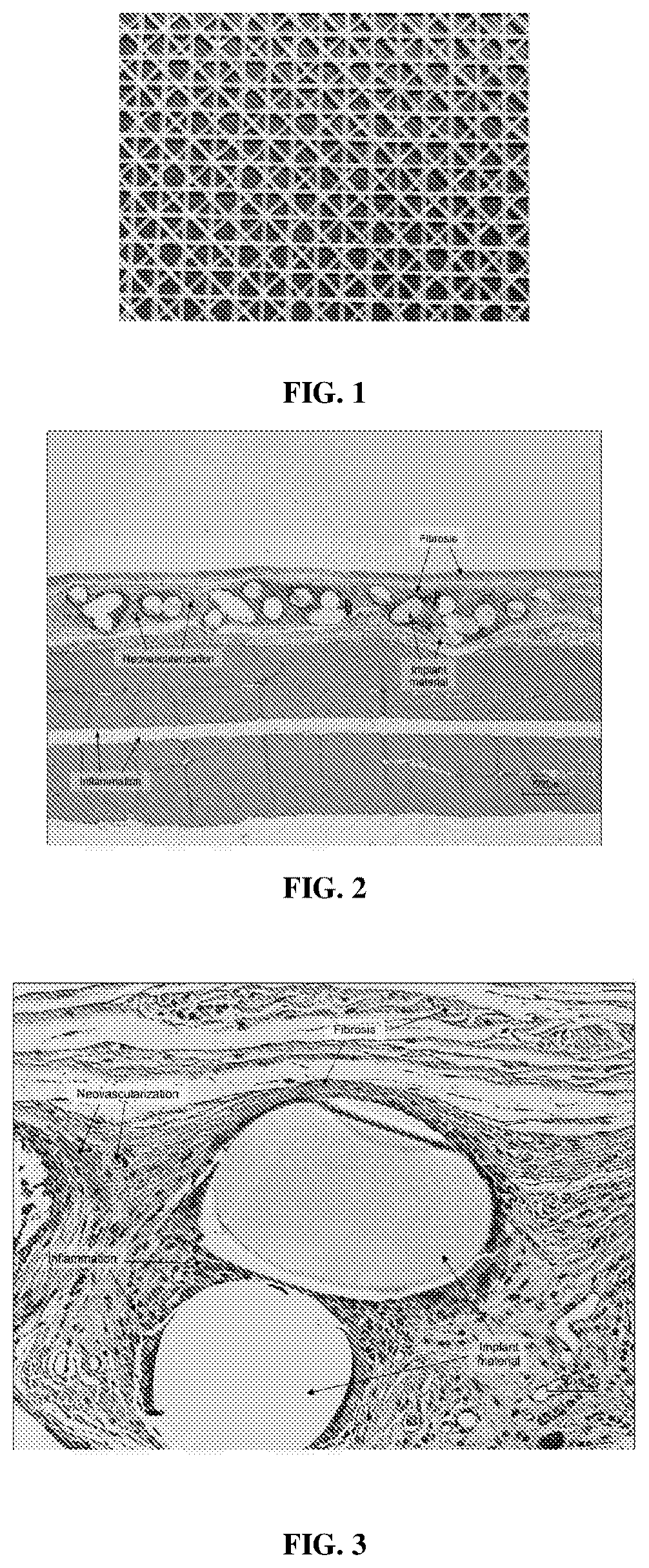 Patent US12616780 Figure 1 – Medical devices containing compositions of poly(butylene succinate) and copolymers thereof
