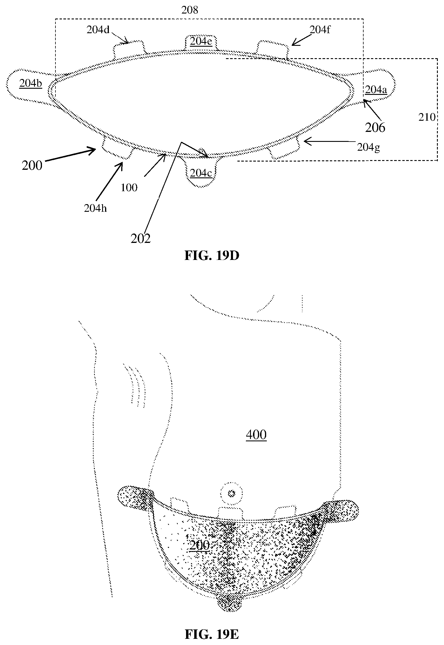Patent US12616780 Figure 12 – Medical devices containing compositions of poly(butylene succinate) and copolymers thereof