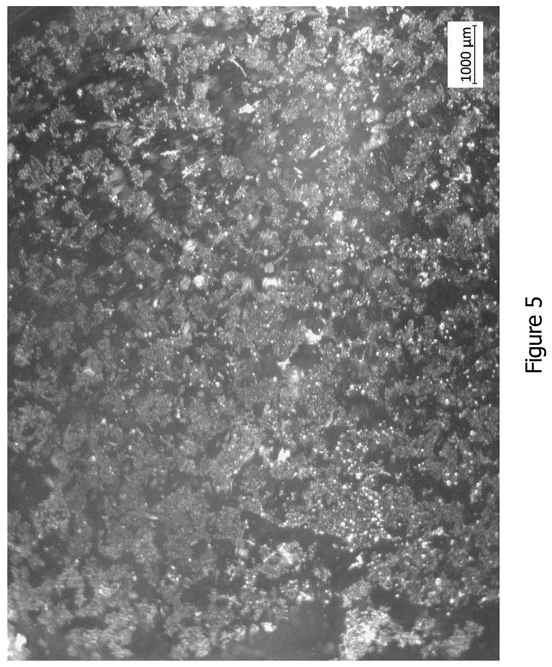 Patent US12616781 Figure 5 – Tubular nonwoven structure as active agent carrier for the atraumatic treatment of hollow organs, and a process for producing the same