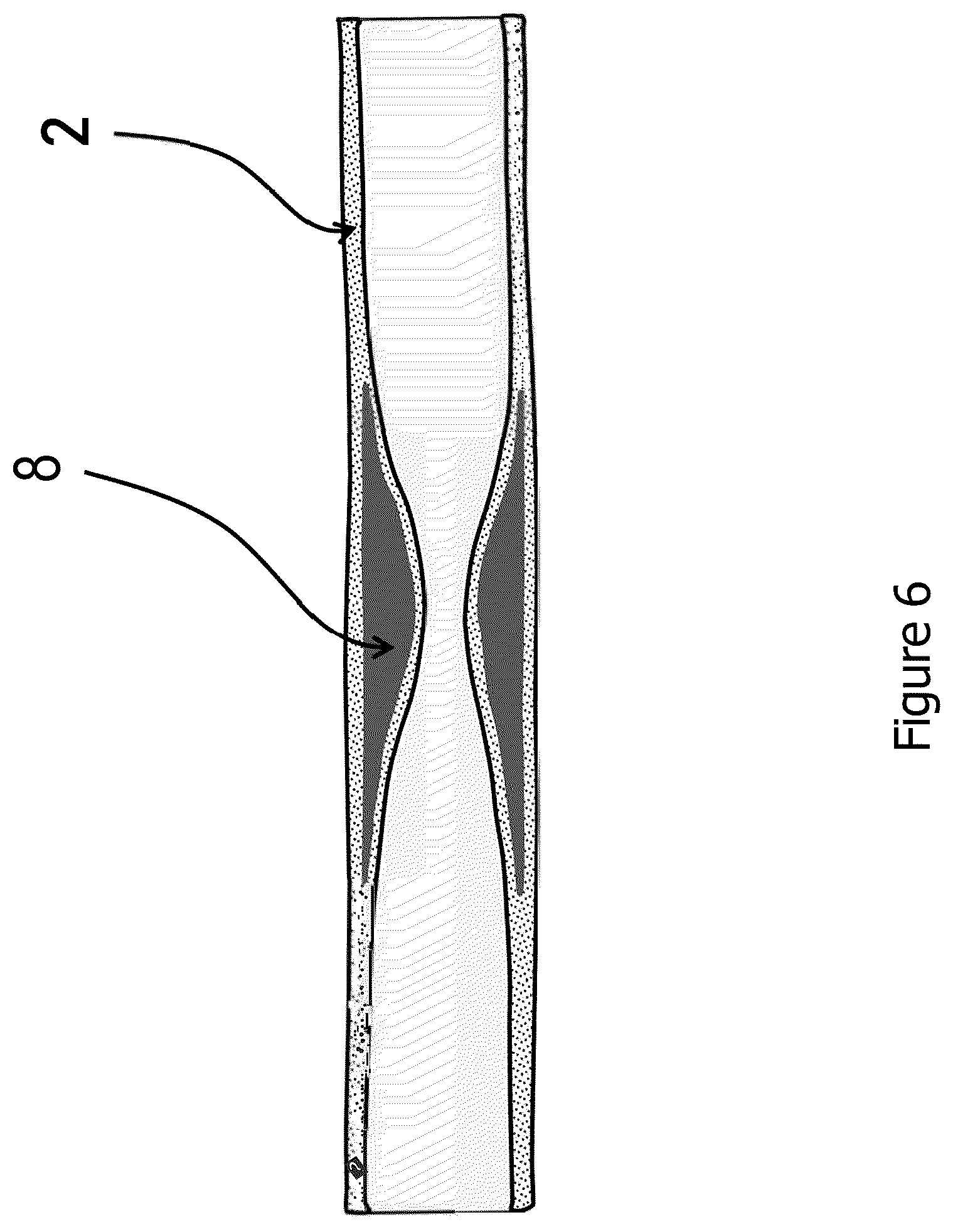 Patent US12616781 Figure 6 – Tubular nonwoven structure as active agent carrier for the atraumatic treatment of hollow organs, and a process for producing the same