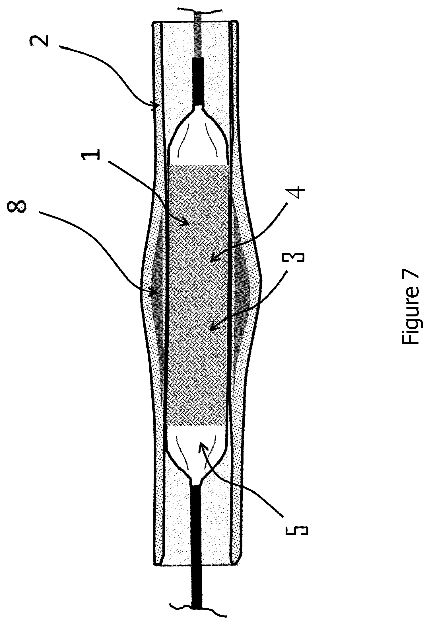 Patent US12616781 Figure 7 – Tubular nonwoven structure as active agent carrier for the atraumatic treatment of hollow organs, and a process for producing the same