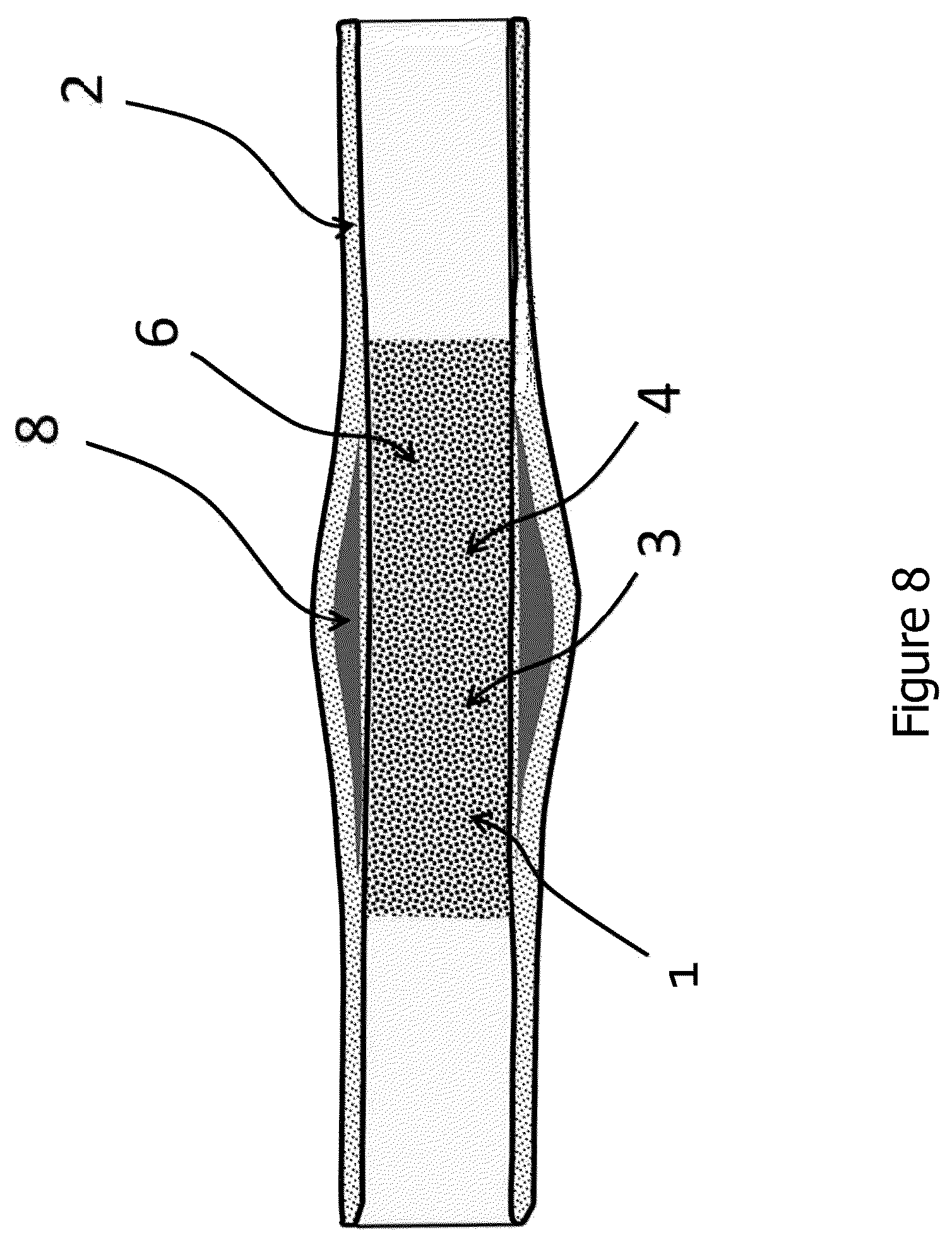 Patent US12616781 Figure 8 – Tubular nonwoven structure as active agent carrier for the atraumatic treatment of hollow organs, and a process for producing the same