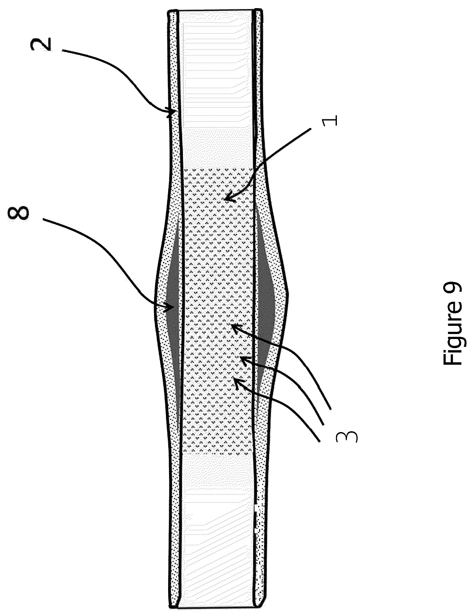 Patent US12616781 Figure 9 – Tubular nonwoven structure as active agent carrier for the atraumatic treatment of hollow organs, and a process for producing the same