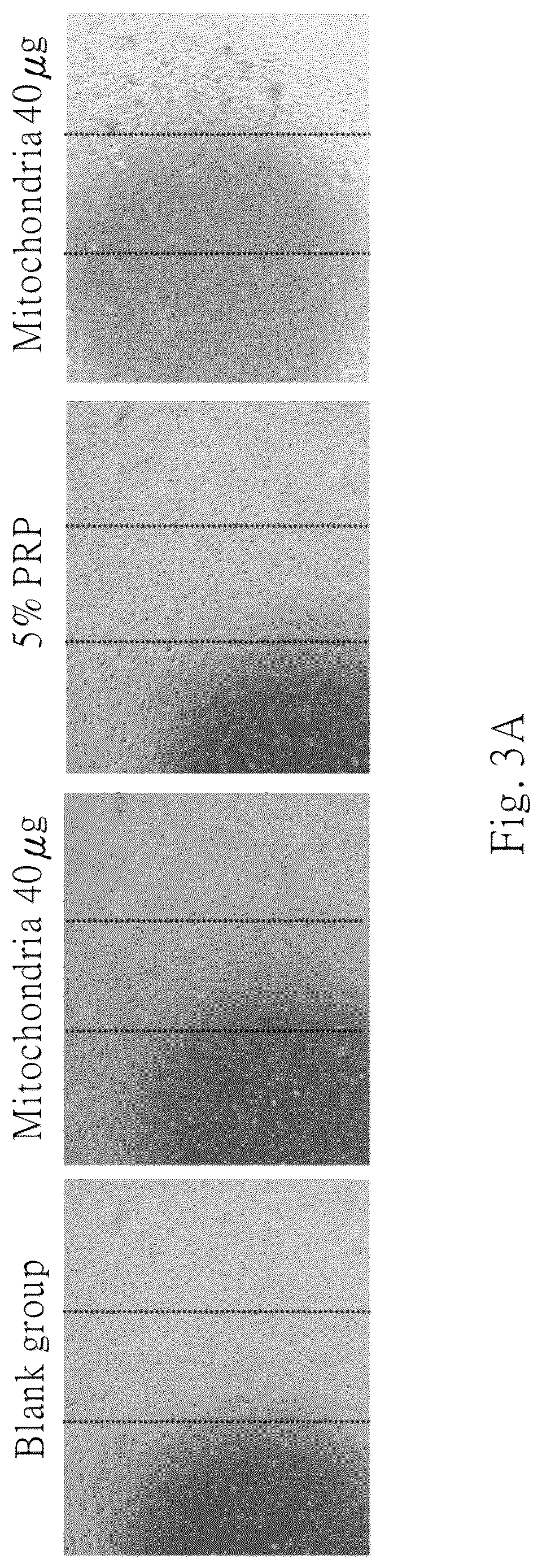 Patent US12616782 Figure 3 – Use of mitochondria to treat and/or prevent tendon injury or its related disease