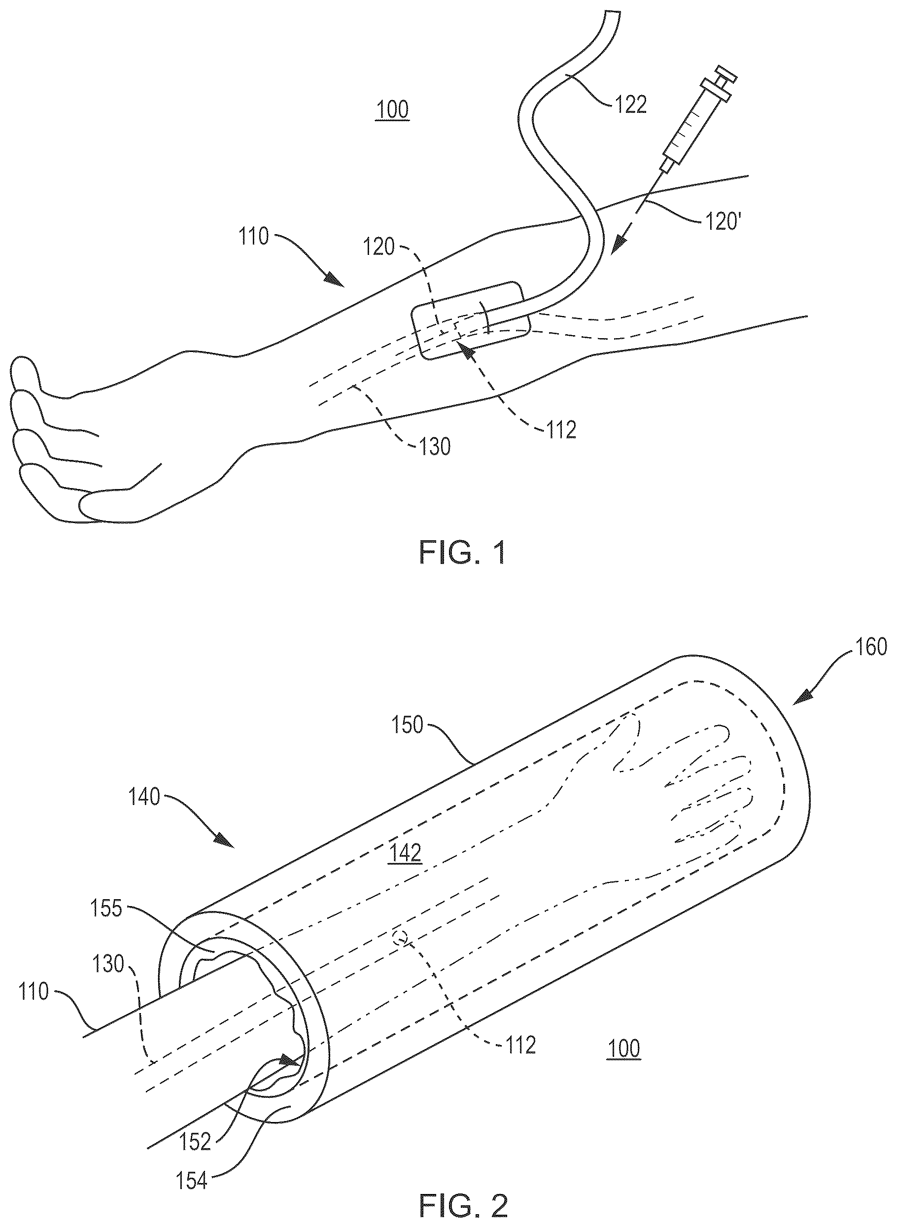 Patent US12616801 Figure 1 – Phlebotomy aid device