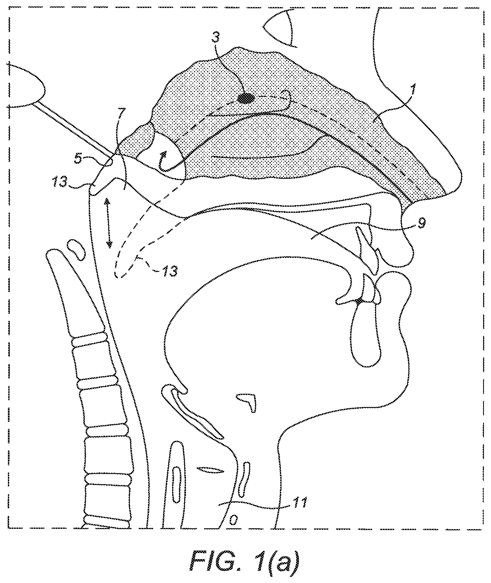 Patent US12616806 Figure 1 – Nasal administration