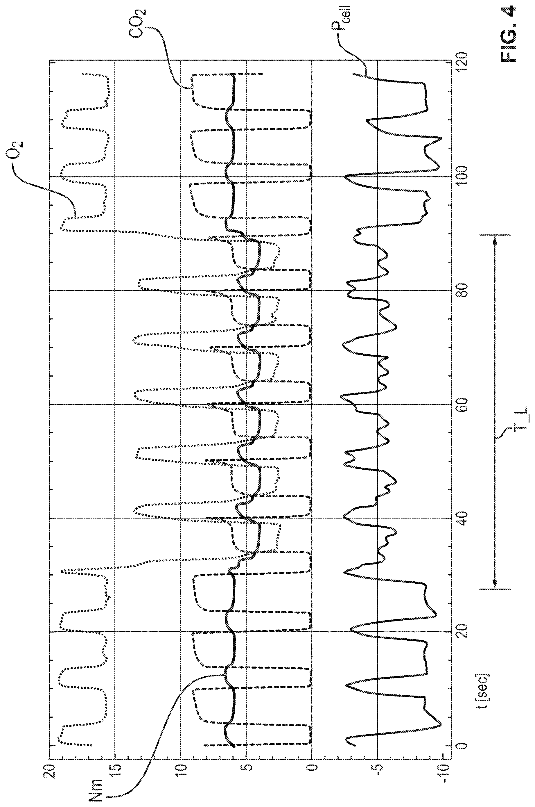Patent US12616808 Figure 4 – Process and device for detection of a leak in a ventilation circuit