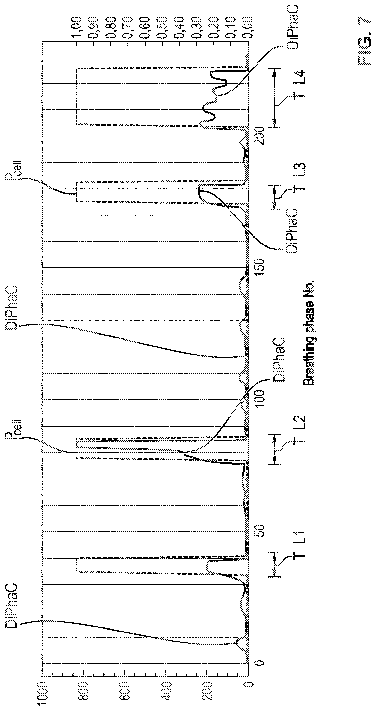 Patent US12616808 Figure 7 – Process and device for detection of a leak in a ventilation circuit