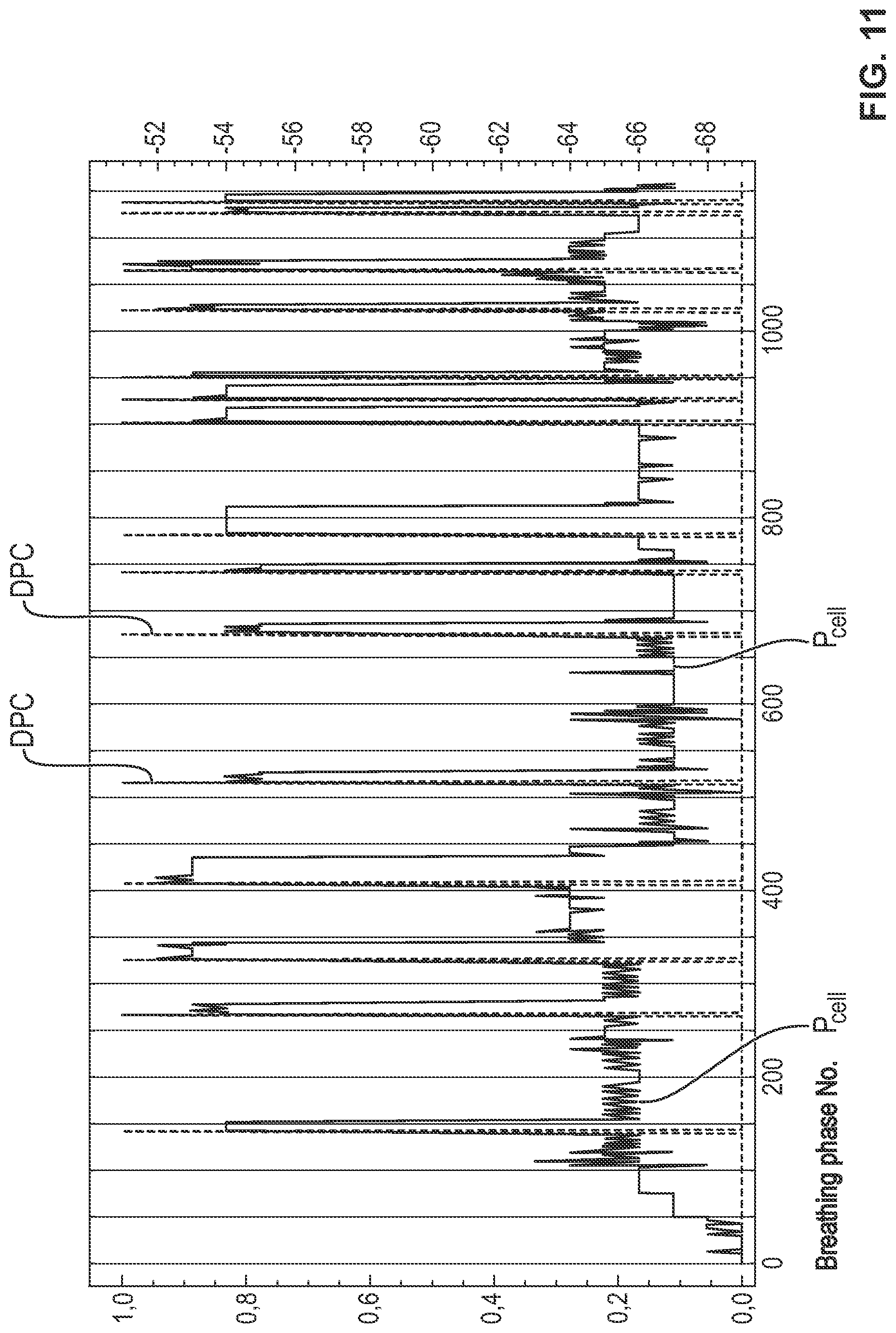Patent US12616808 Figure 11 – Process and device for detection of a leak in a ventilation circuit