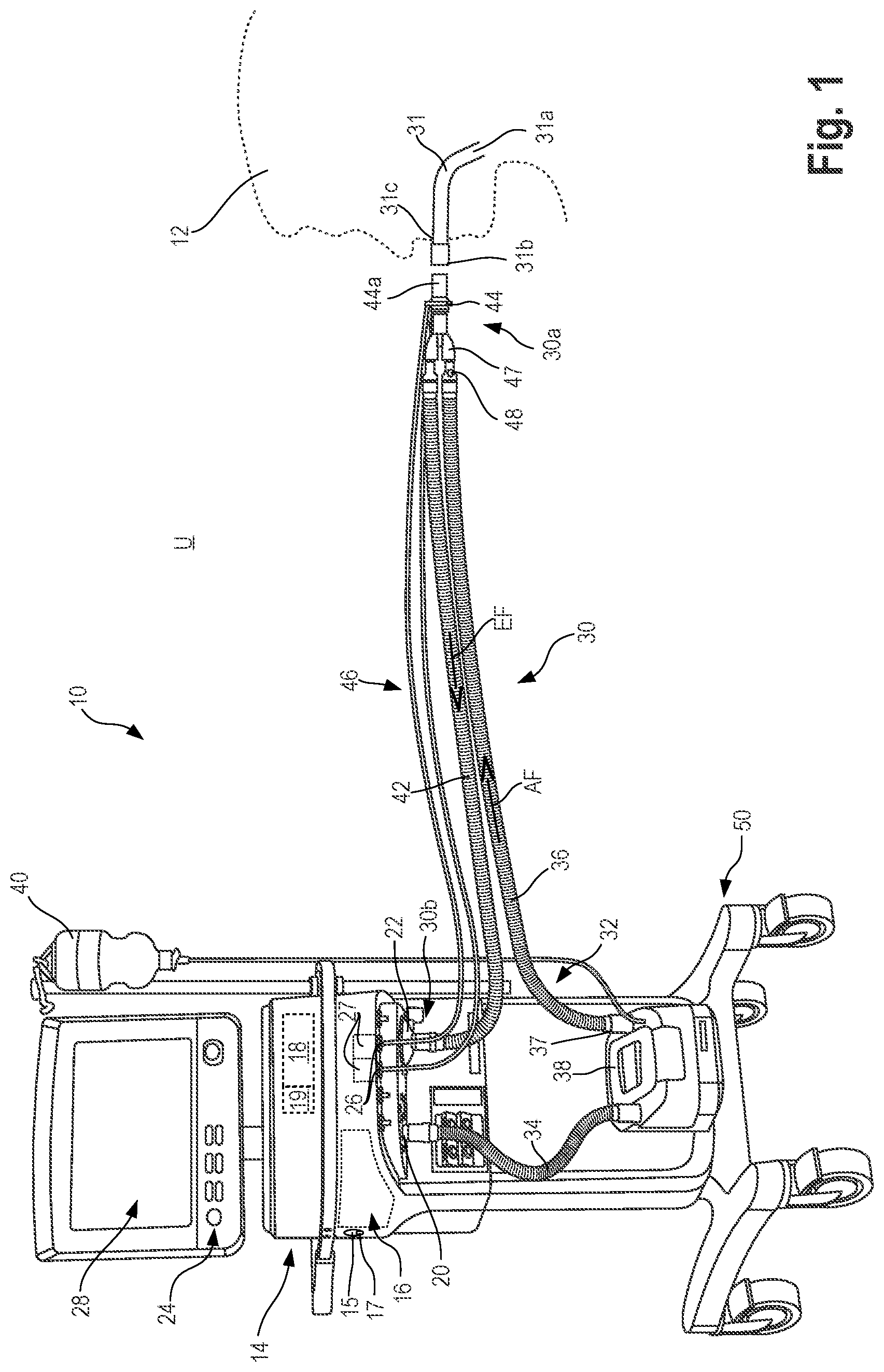Patent US12616809 — Method for carrying out a P/V maneuver which automatically prevents an overdilation of the lungs, and ventilation device designed to carry out the method — Figure 1