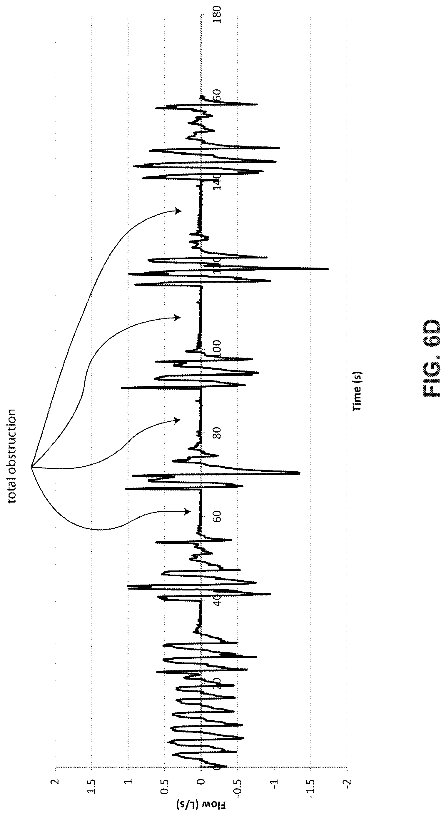 Patent US12616812 Figure 12 – Methods and apparatus for treating respiratory disorders