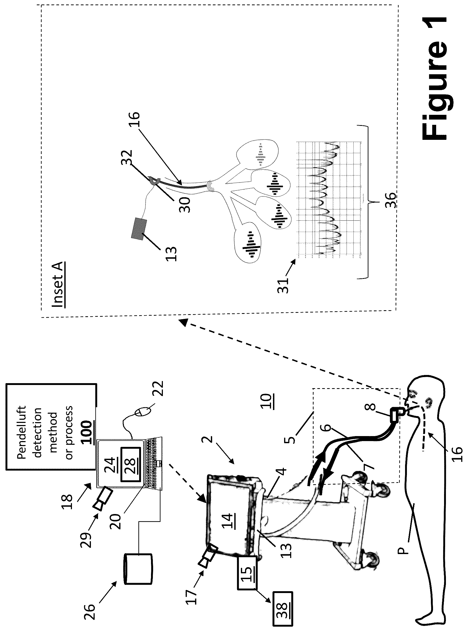 Patent US12616813 Figure 1 – Pendelluft detection by acoustic interferometry through an endotracheal tube