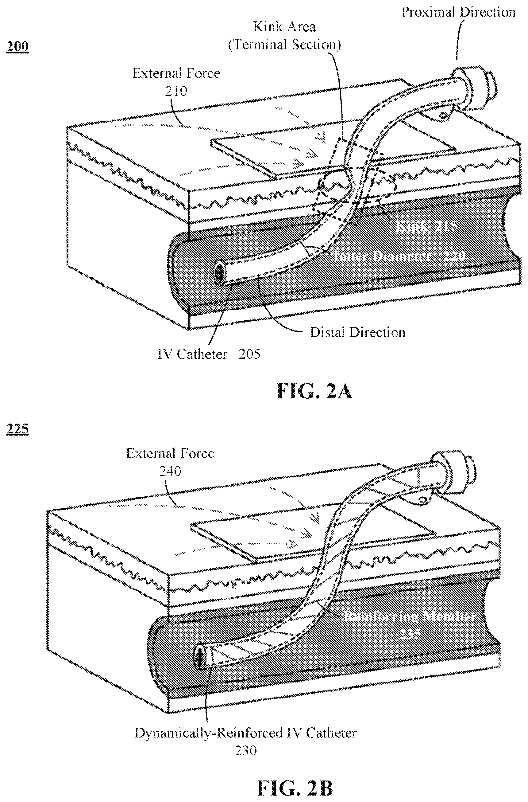 Patent US12616815 Figure 2 – Intravenous catheter reinforced to maintain volumetric integrity