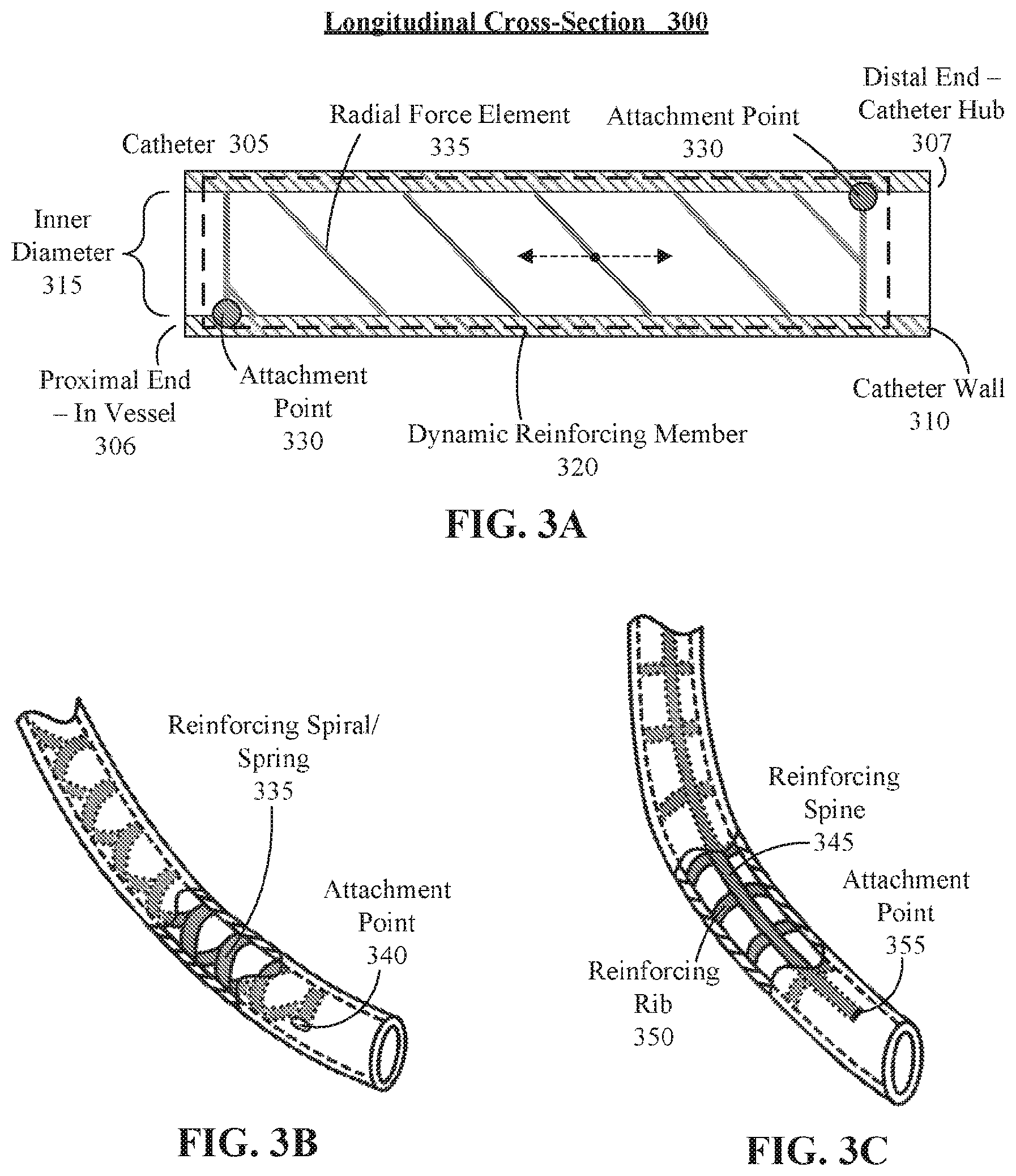 Patent US12616815 Figure 3 – Intravenous catheter reinforced to maintain volumetric integrity