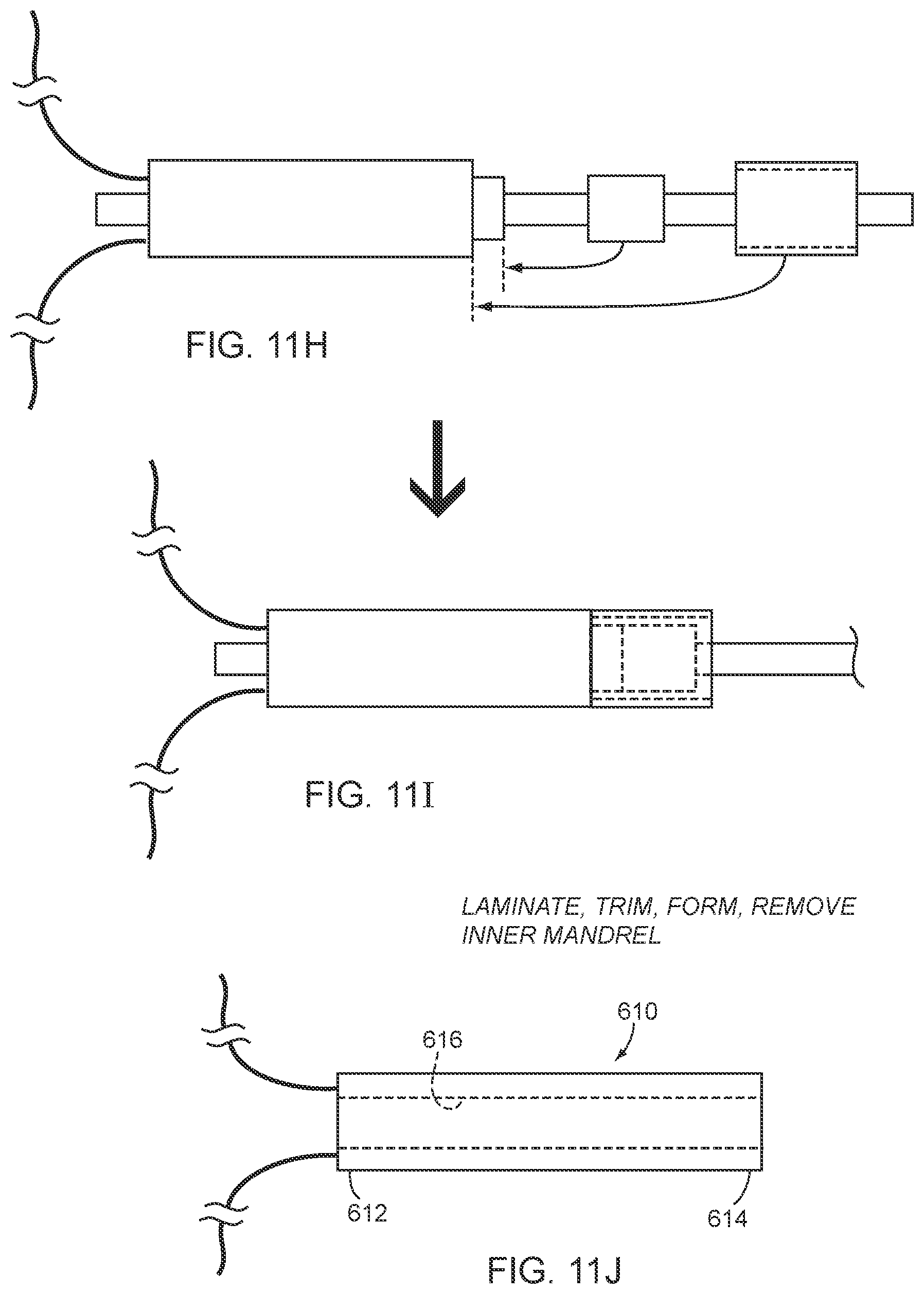 Patent US12616816 Figure 10 – Catheter devices and methods for making them