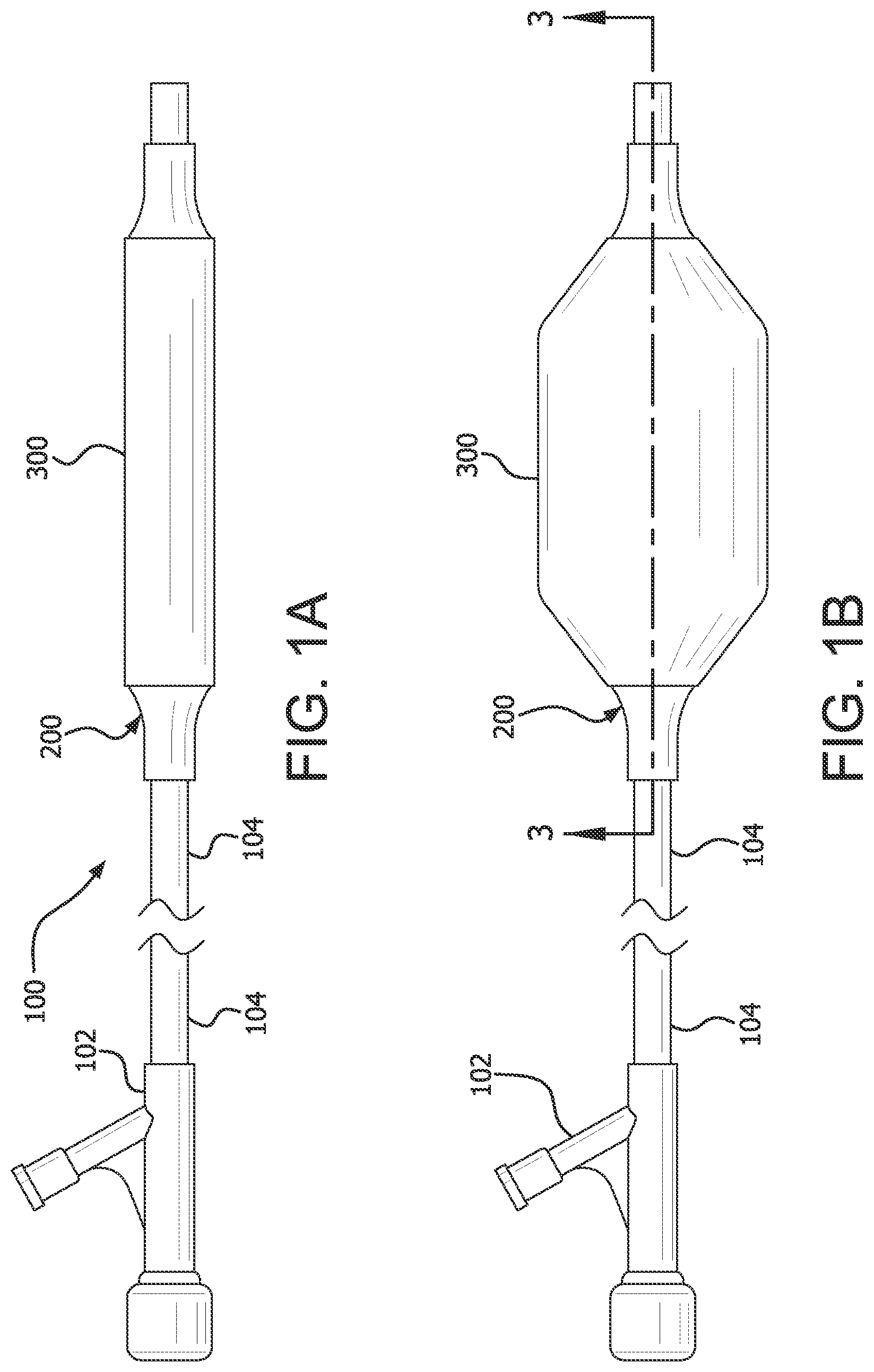 Patent US12616819 Figure 1 – Controllable inflation profile balloon cover methods