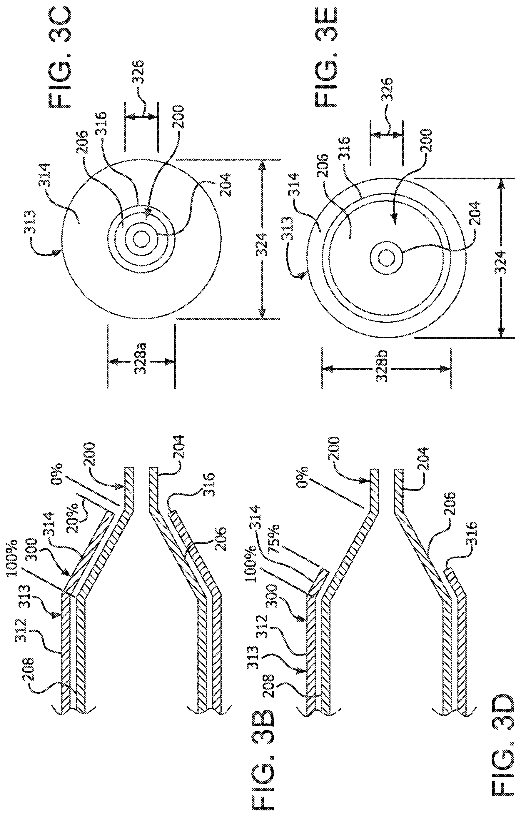 Patent US12616819 Figure 3 – Controllable inflation profile balloon cover methods