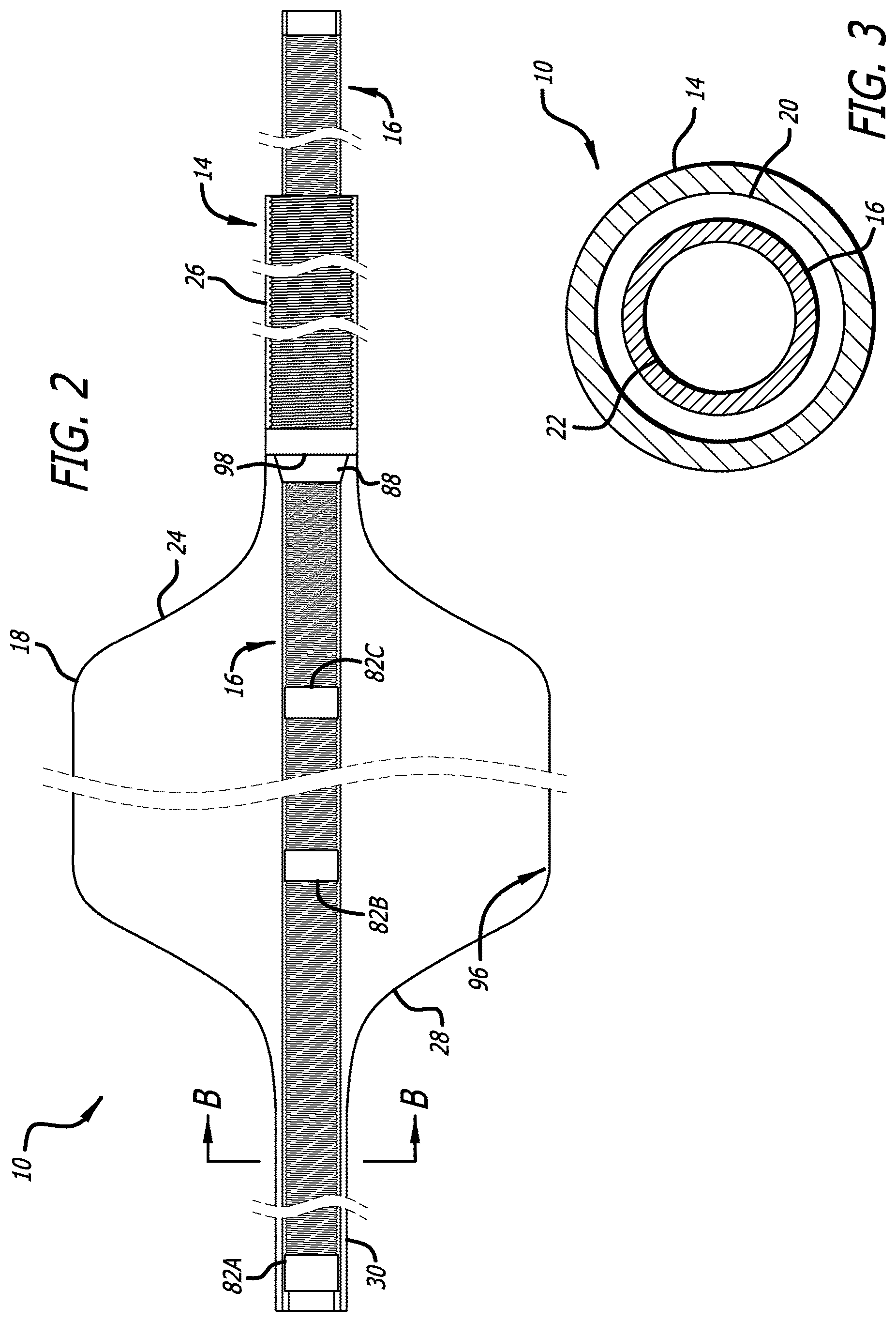 Patent US12616820 Figure 2 – Reinforced balloon catheter
