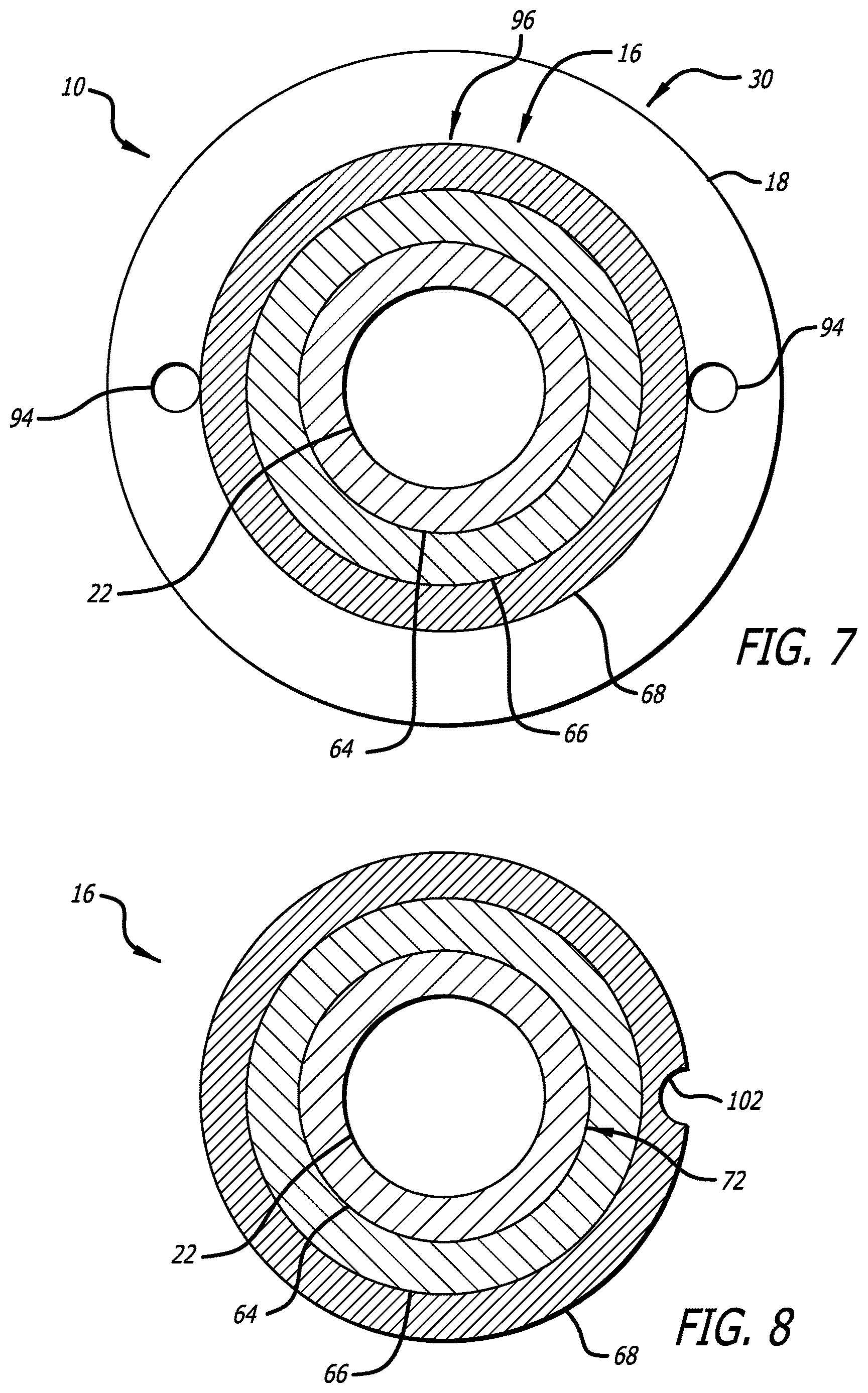 Patent US12616820 Figure 6 – Reinforced balloon catheter