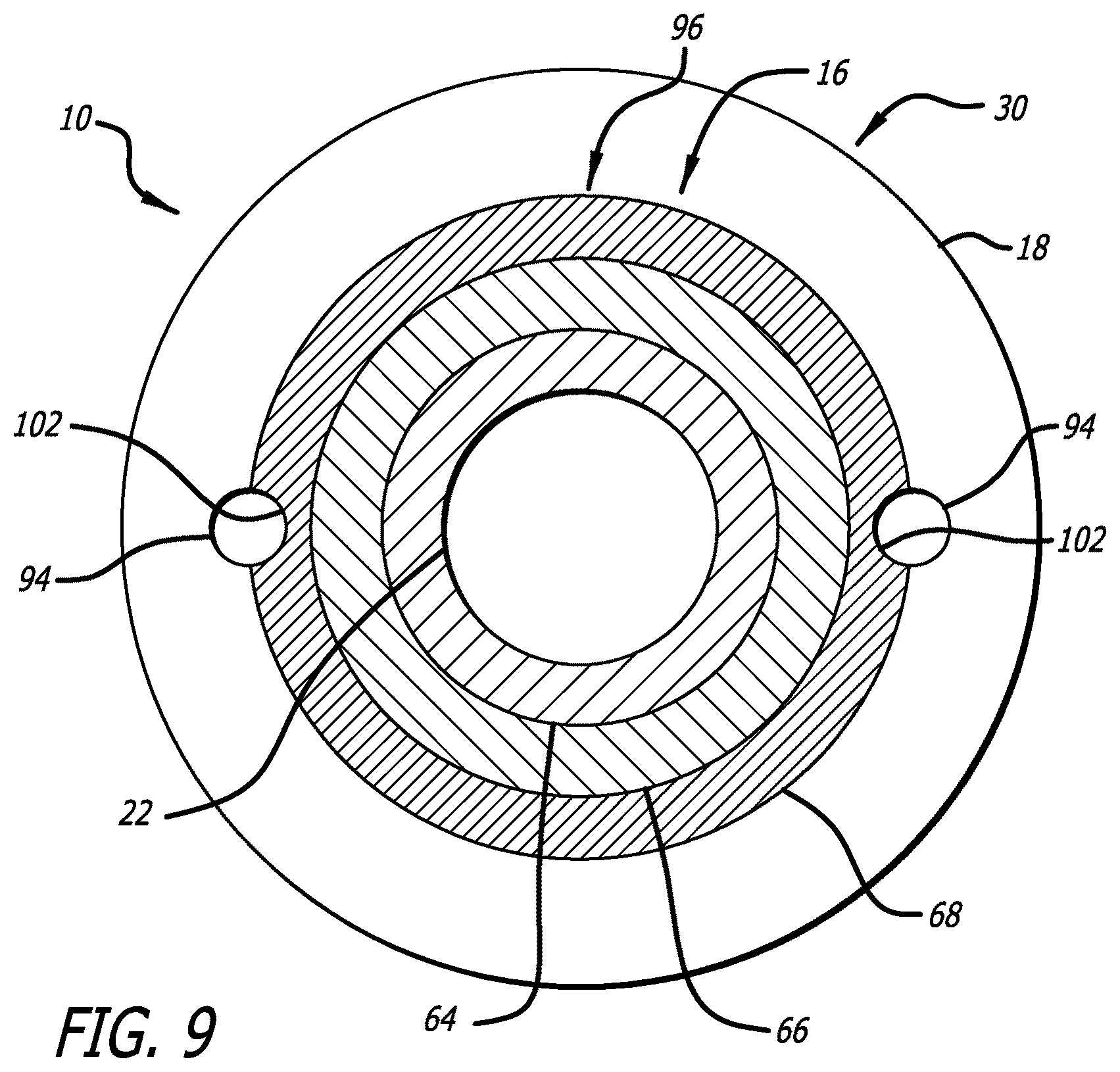 Patent US12616820 Figure 7 – Reinforced balloon catheter
