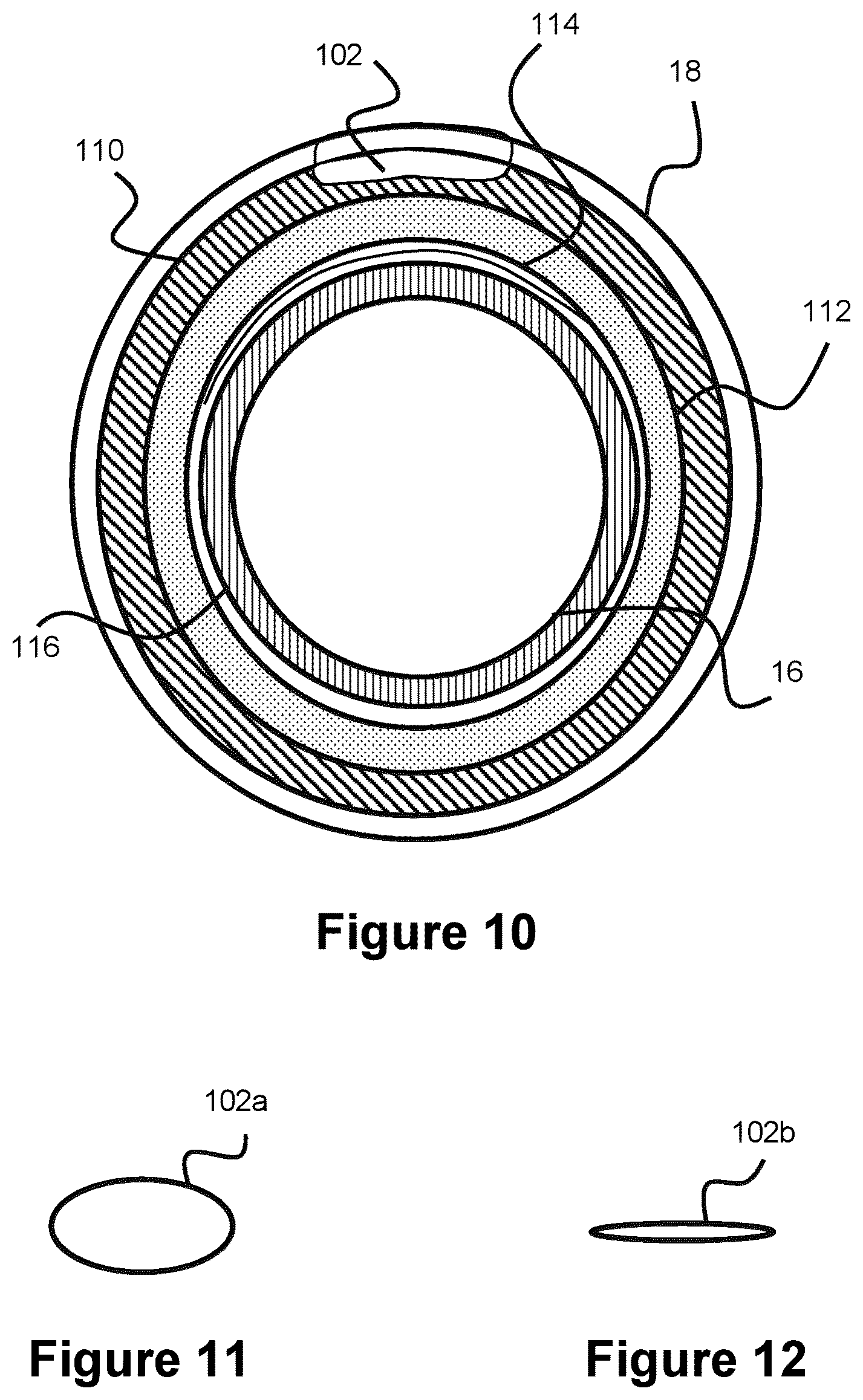 Patent US12616820 Figure 8 – Reinforced balloon catheter