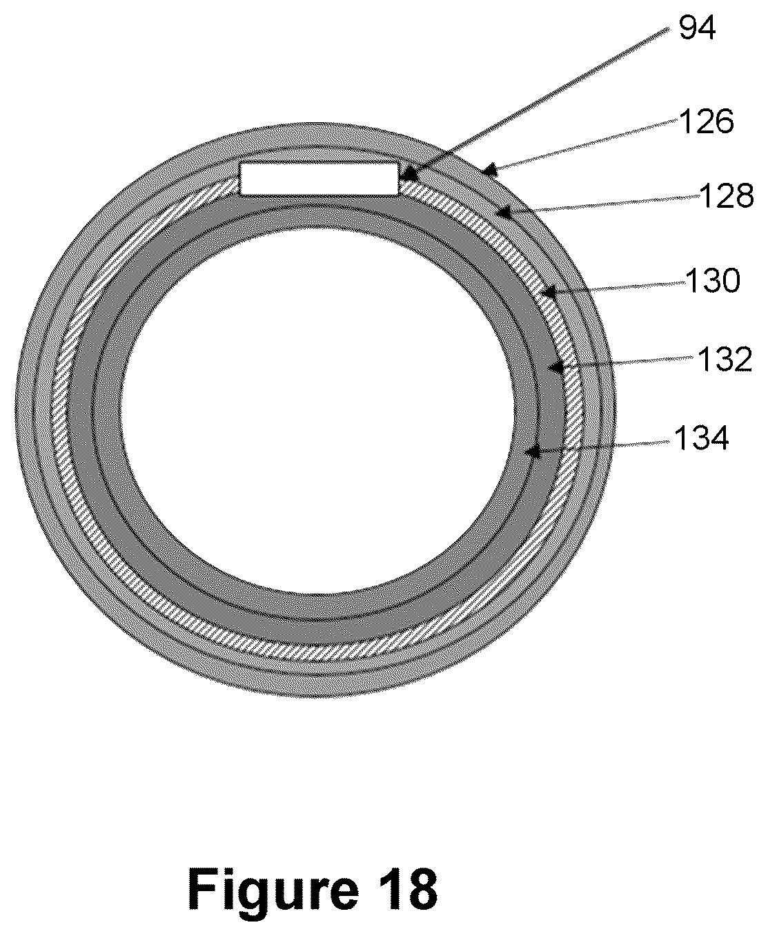 Patent US12616820 Figure 12 – Reinforced balloon catheter