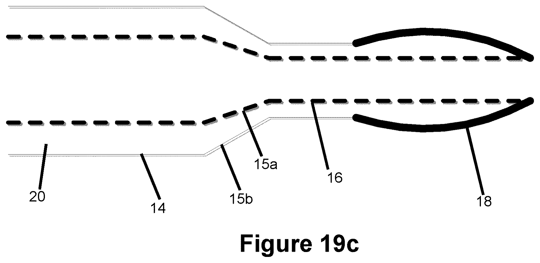 Patent US12616820 Figure 14 – Reinforced balloon catheter