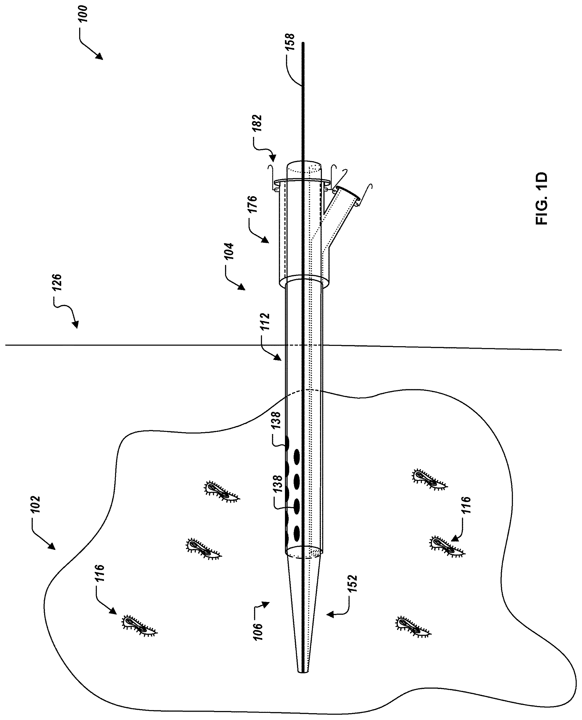 Patent US12616821 Figure 3 – Abscess catheter