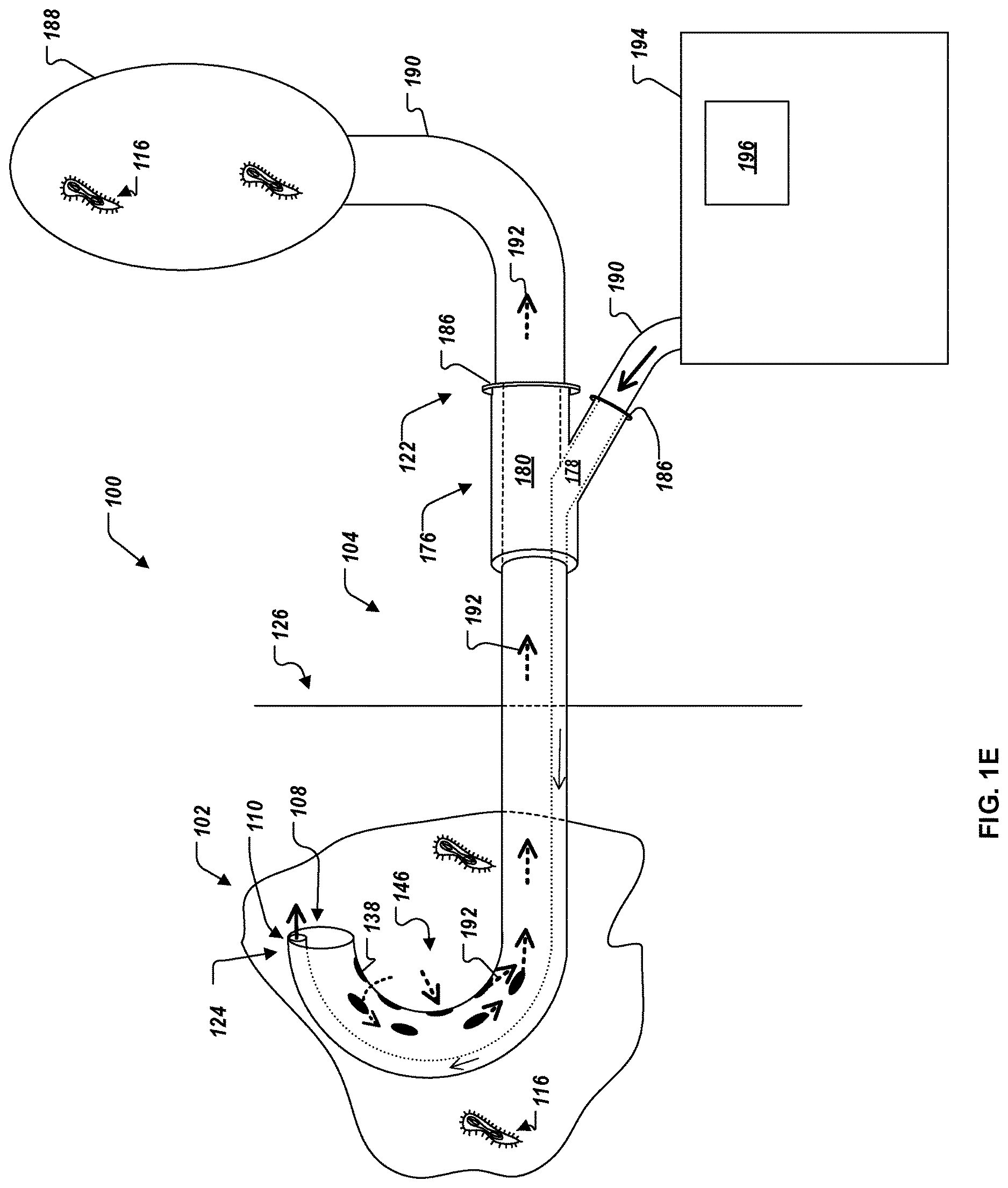 Patent US12616821 Figure 4 – Abscess catheter